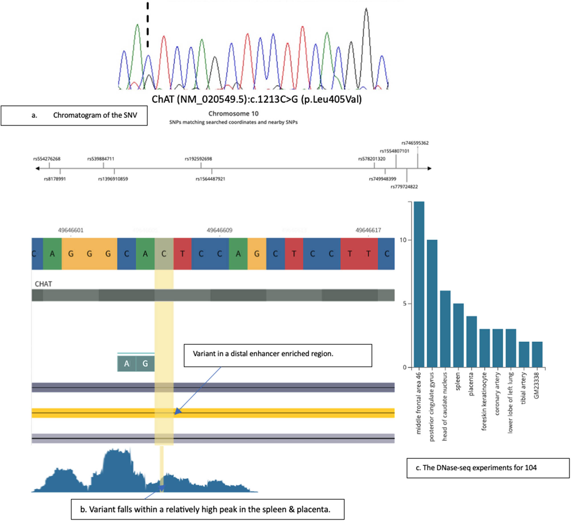 Figure 1 
               Identification and genomic context of the novel ChAT variant c.1213C>G. (a) Sanger sequencing chromatogram showing the heterozygous C>G variant (NM_020549.5:c.1213C>G) identified in the GDM patient compared to the reference consensus sequence. The arrow indicates the position of the variant. (b) Genomic view of the variant locus annotated with RegulomeDB data, indicating the variant’s position within a predicted distal enhancer region exhibiting repressive chromatin marks. (c) DNase-seq tracks displaying chromatin accessibility (peaks) at the variant locus across multiple tissues. Signals indicative of open chromatin are highlighted in the spleen and the placenta.