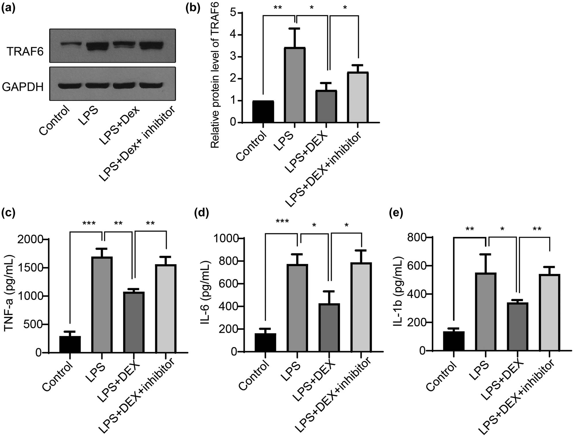 Figure 3 
                  Dexmedetomidine attenuates LPS-induced microglia activation via modulating the mmu-miR-125a/TRAF6 axis. (a) and (b) BV2 cells were treated with LPS and DEX or miR-125a inhibitor, then the cell lysates were subjected to western blotting for determining the TRAF6 level (fold changes). The supernatant from the same treatment was subjected to an ELISA assay to detect the secreted levels of TNF-alpha (c), IL-6 (d), and IL-1beta (e). ANOVA multiple comparisons, *P < 0.05; **P < 0.01; ***P < 0.001.
               