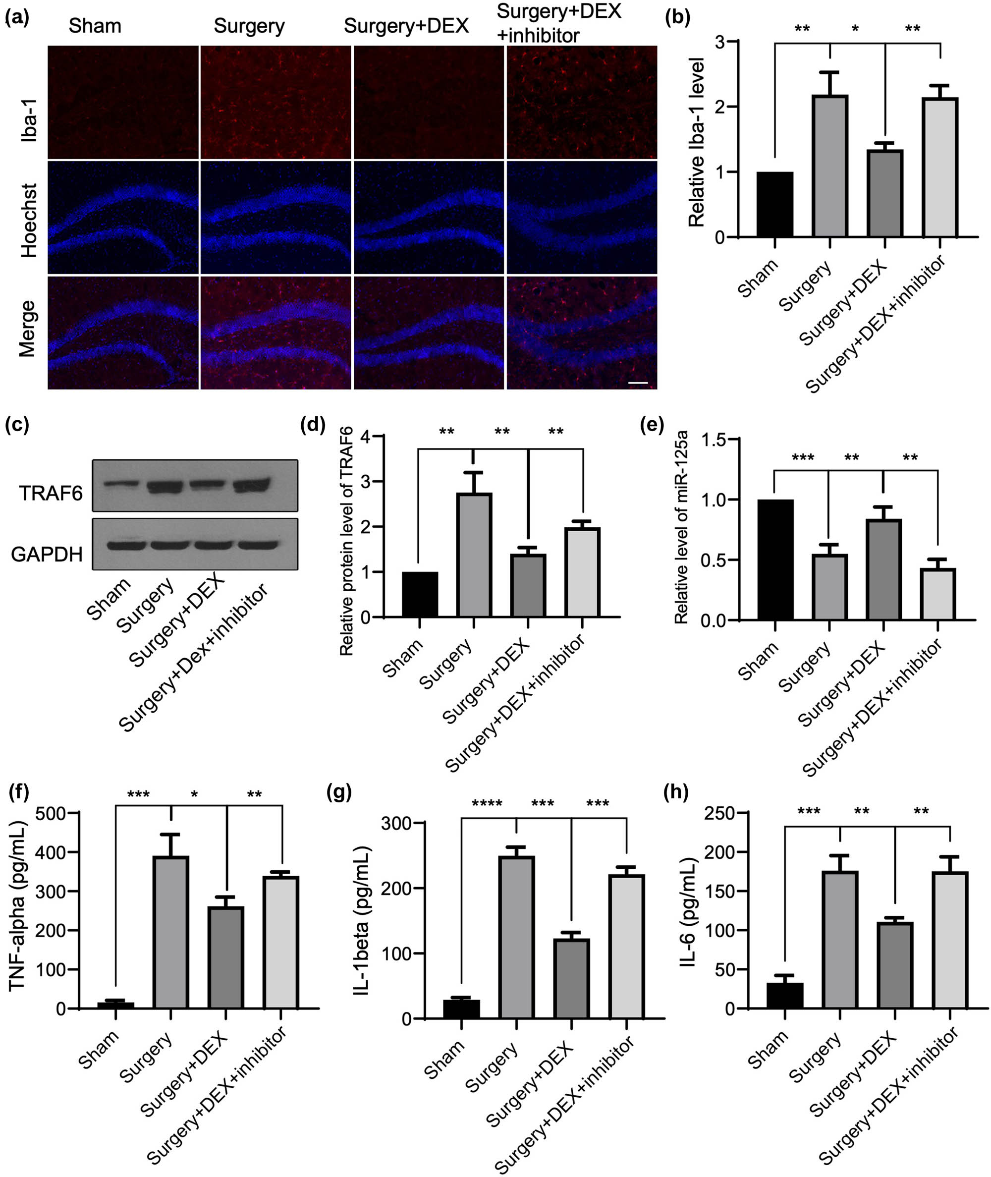 Figure 4 
                  Dexmedetomidine alleviates neuroinflammation in a POCD surgical trauma model via the mmu-miR-125a/TRAF6 axis. (a) and (b) A POCD surgical trauma model was established, and then mice were treated with Dex or injected with the mmu-miR-125a inhibitor. The Sham group was used as the control group of the surgery group. After surgery or pharmacal administration, the hippocampus tissues were subjected to immunohistochemistry to detect the level of Iba-1 (red, for activated microglia). (c) and (d) The protein level of TRAF6 and mmu-miR-125a (e) in the hippocampus was detected and quantified as relative fold changes. The serum level from treated mice was collected to detect the level of TNF-alpha (f), IL-6 (g), and IL-1beta (h). Scale bar, 20 μm. ANOVA multiple comparisons, *P < 0.05; **P < 0.01; ***P < 0.001; ****P < 0.0001.
               