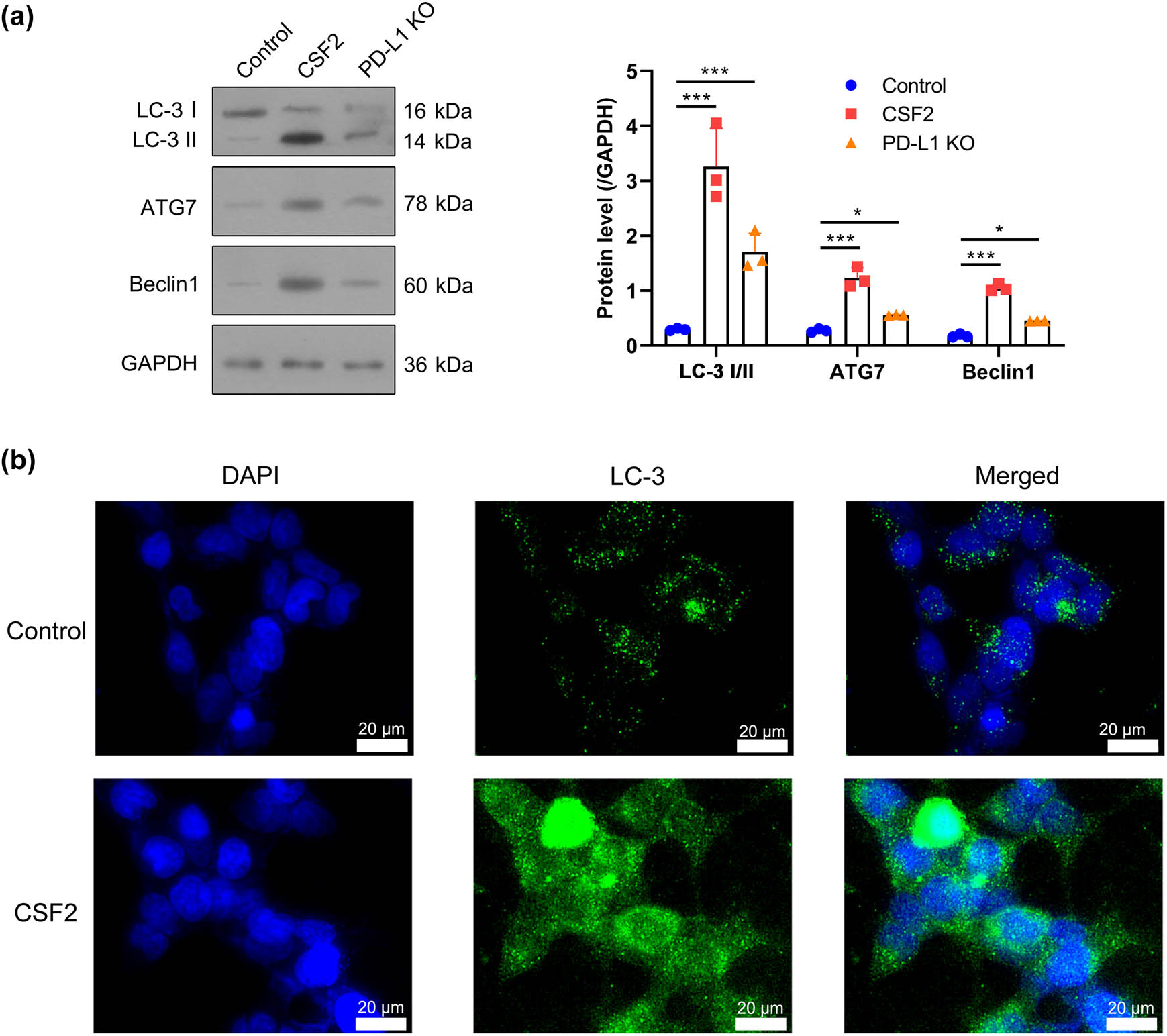 Figure 5 
                  Autophagy activation by CSF2-treated neutrophils depends on PD-L1. (a) Western blot analysis of LC-3, ATG7, and Beclin1 protein levels in co-cultured renal cancer cells. Data are presented as mean ± SD (n = 3). Statistical significance was assessed using one-way ANOVA. Compared with the control group, ***
                     P < 0.001. (b) Immunofluorescence staining of LC-3 in renal cancer cells with DAPI as a nuclear counterstain. LC-3: Microtubule-associated protein 1A/1B-light chain 3; ATG7: Autophagy-related 7; DAPI: 4′,6-diamidino-2-phenylindole.