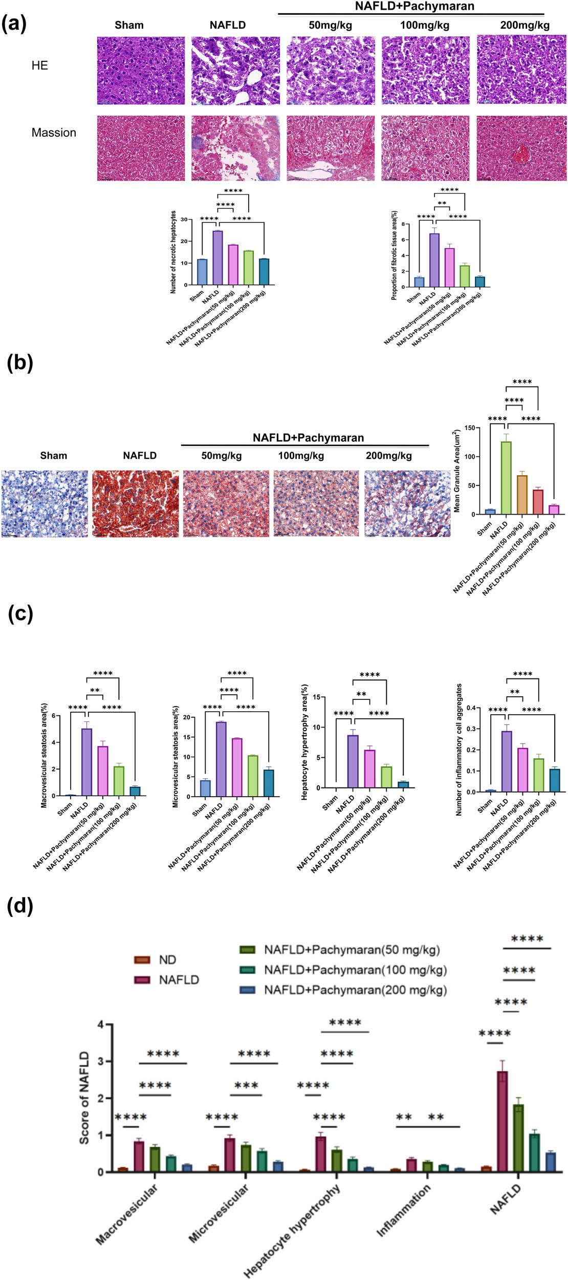 Figure 3 
                  Pachymaran prevented liver injury in mice with NAFLD. (a) Morphological images of liver tissue stained with hematoxylin and eosin and Masson’s trichrome. (b) Morphological images of liver tissue stained with Oil Red O (100×). (c) Percentage of hepatic bullous steatosis, vesicular steatosis, hypertrophic area of hepatocytes, and number of inflammatory cell aggregates in the liver tissue. (d) Hepatic bullous steatosis, vesicular steatosis, hypertrophic area of hepatocytes, and inflammatory cell aggregate scores and total NAFLD score. n = 3, *P < 0.05, **P < 0.01, ***P < 0.001, ****P < 0.0001. (magnification, 200×).
               