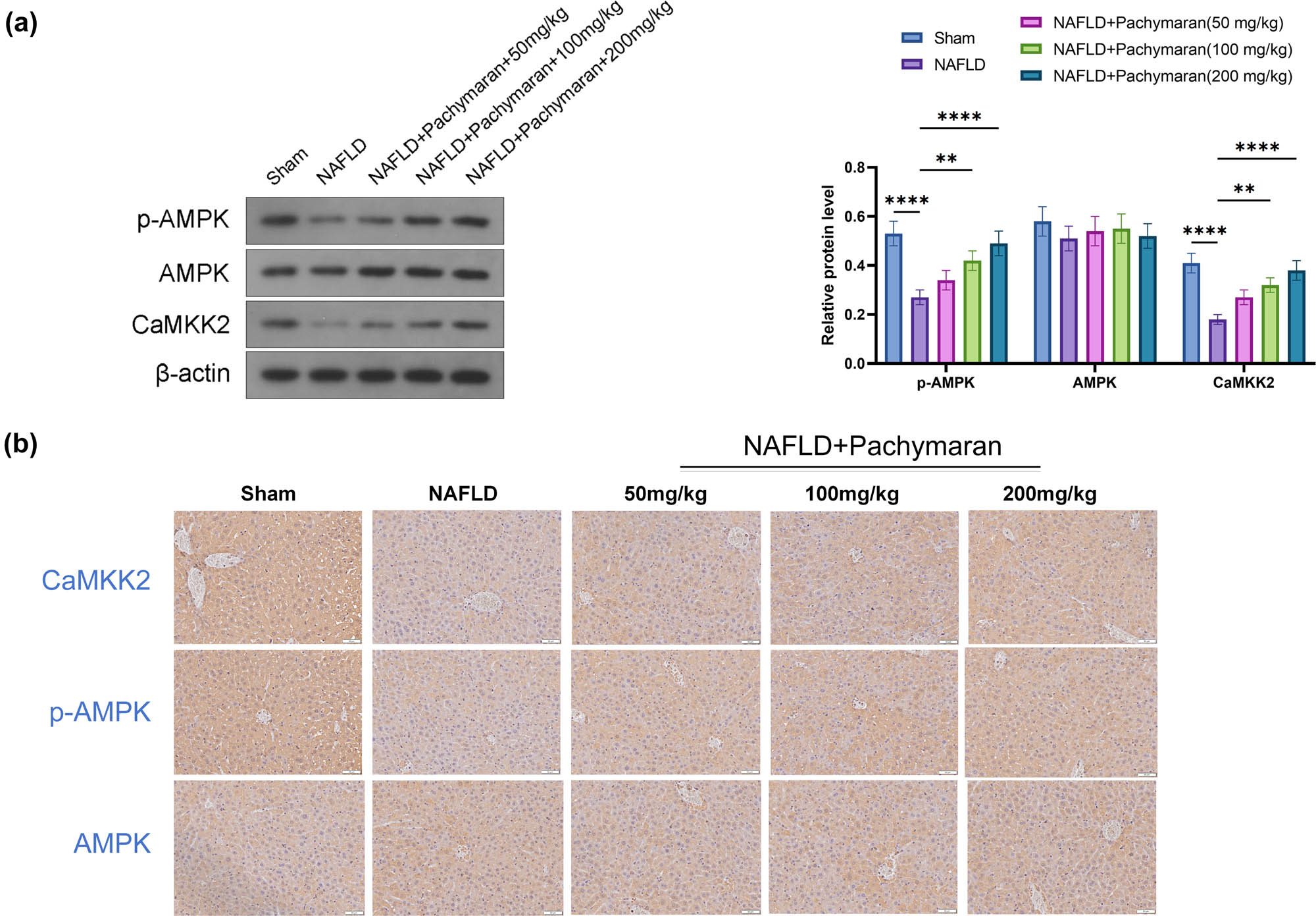 Figure 4 
                  The p-AMPK, AMPK, and CaMKK2 levels in mice with NAFLD. (a) Western blot reflected the expression of p-AMPK, AMPK, and CaMKK2. (b) Immunohistochemistry staining reflected the expression of p-AMPK, AMPK, and CaMKK2. n = 6, *P < 0.05, **P < 0.01, ***P < 0.001, ****P < 0.0001.
               