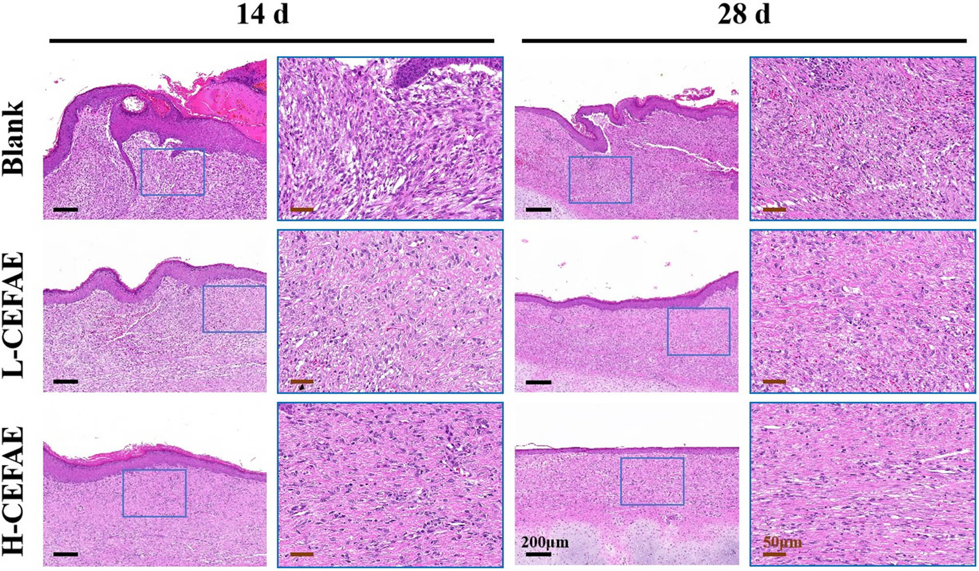 Figure 2 
                  HE staining of blank, L-CEFAE and H-CEFAE with 14 and 28 days.
               