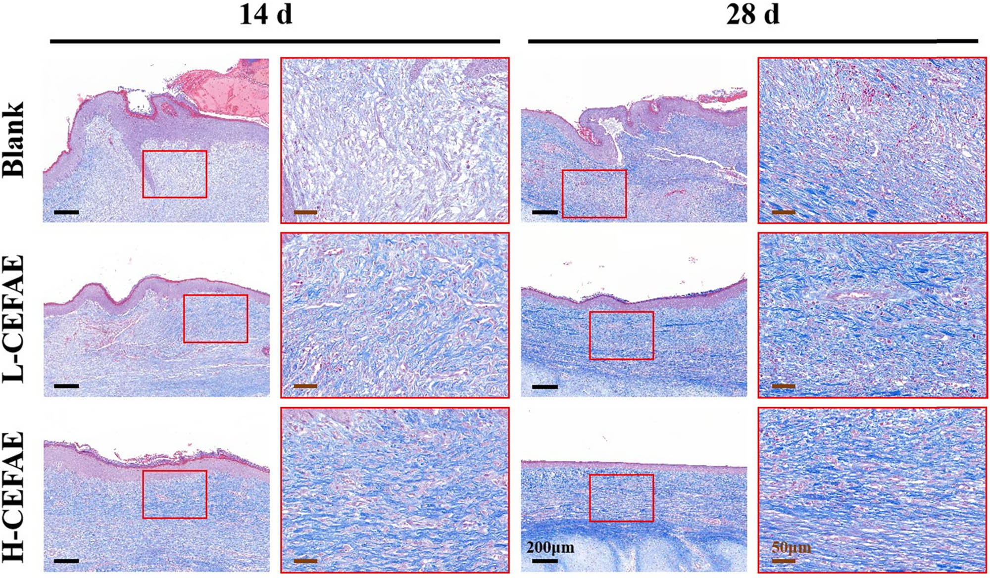 Figure 3 
                  Masson staining of blank, L-CEFAE, and H-CEFAE at 14 and 28 days.
               