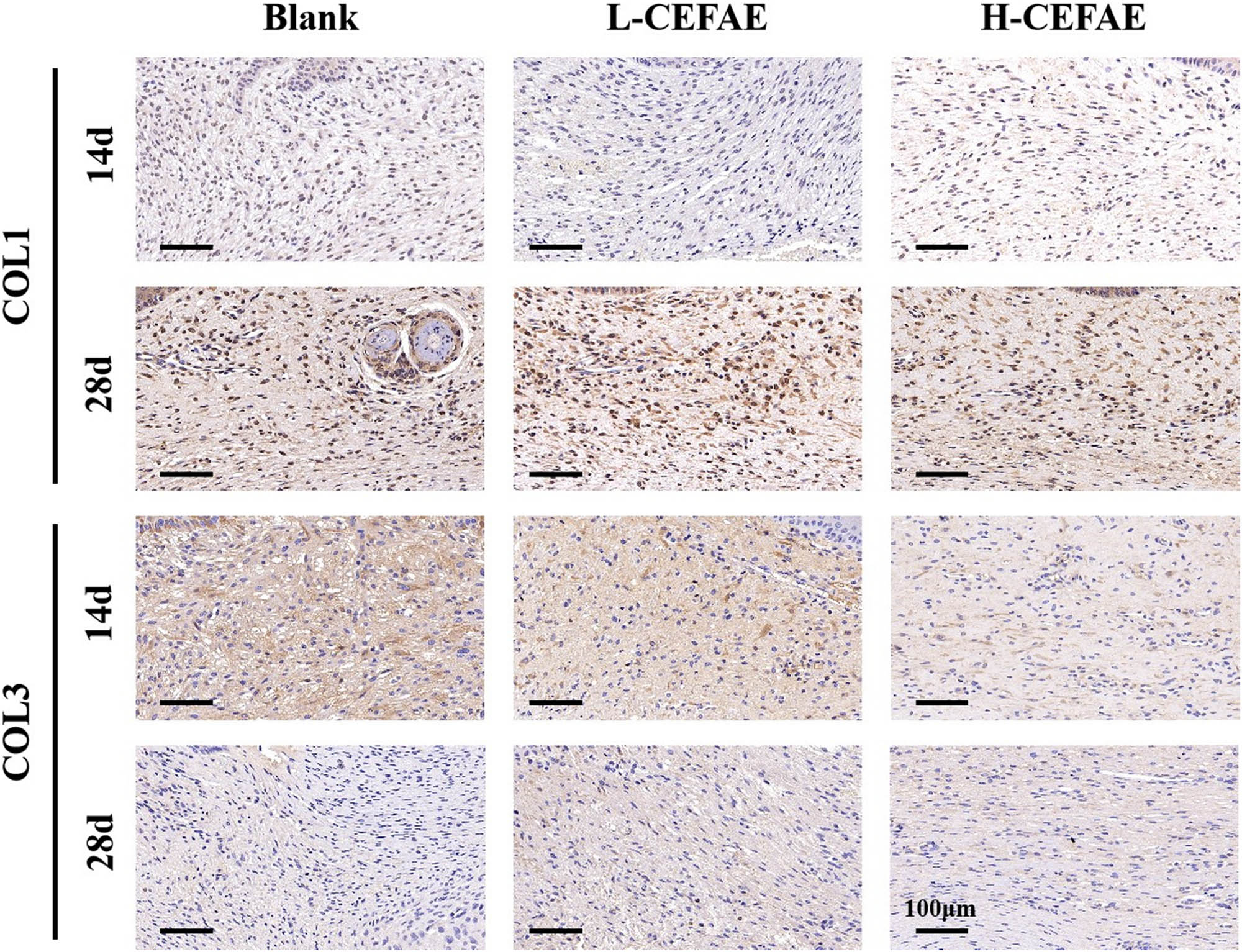 Figure 4 
                  COL I and COL III staining of blank, L-CEFAE, and H-CEFAE at 14 and 28 days.
               