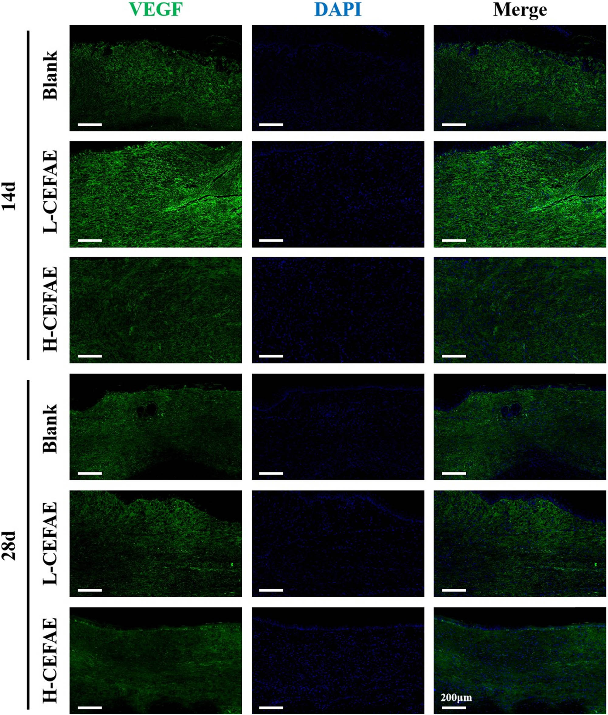 Figure 5 
                  VEGF staining of blank, L-CEFAE, and H-CEFAE at 14 and 28 days.
               