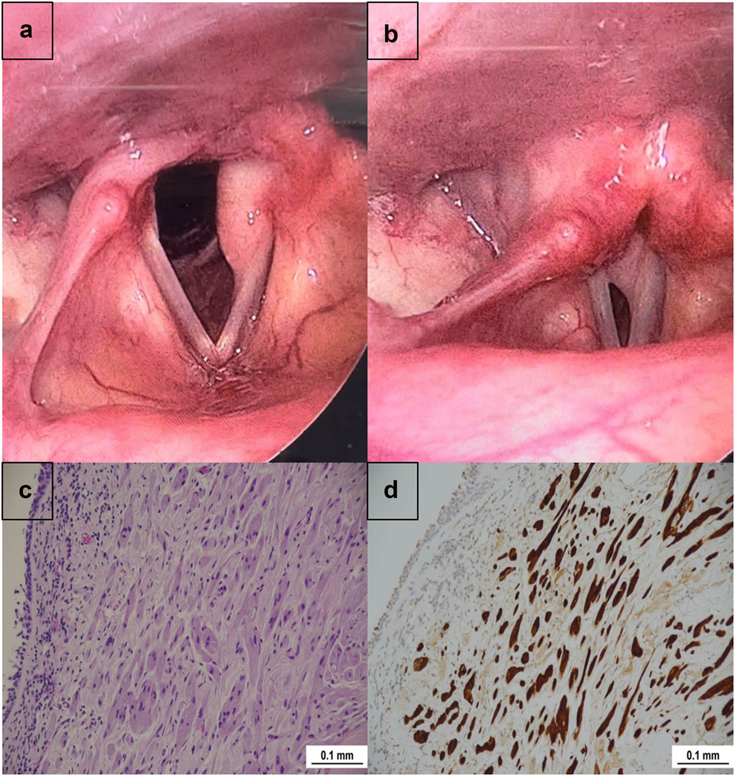 Teaser image from the article