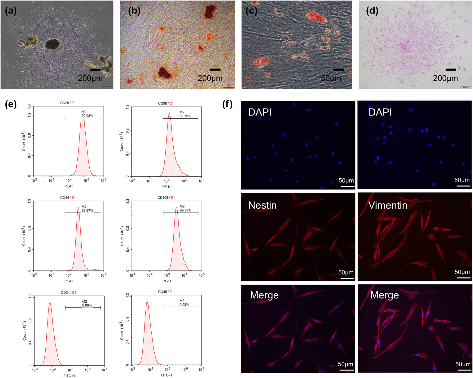 Figure 2 
                  Culture and identification of hPDLSCs. (a) Primary cells cultured by periodontal ligament tissue. (b) Alizarin Red S staining of hPDLSCs after being cultured in osteogenic differentiating medium. (c) Oil Red O staining of hPDLSCs after being cultured in adipocytic differentiating medium. (d) Cell colony formation was observed after crystal violet staining. (e) Flow cytometric analysis of surface markers in hPDLSCs, CD29-PE (99.98%), CD90-PE (98.75%), CD105-PE (99.99%), CD44-PE (99.97%), CD34-FITC (0.06%), and CD45-FITC (0.02%). (f) Vimentin expression and Nestin expression in hPDLSCs.
               