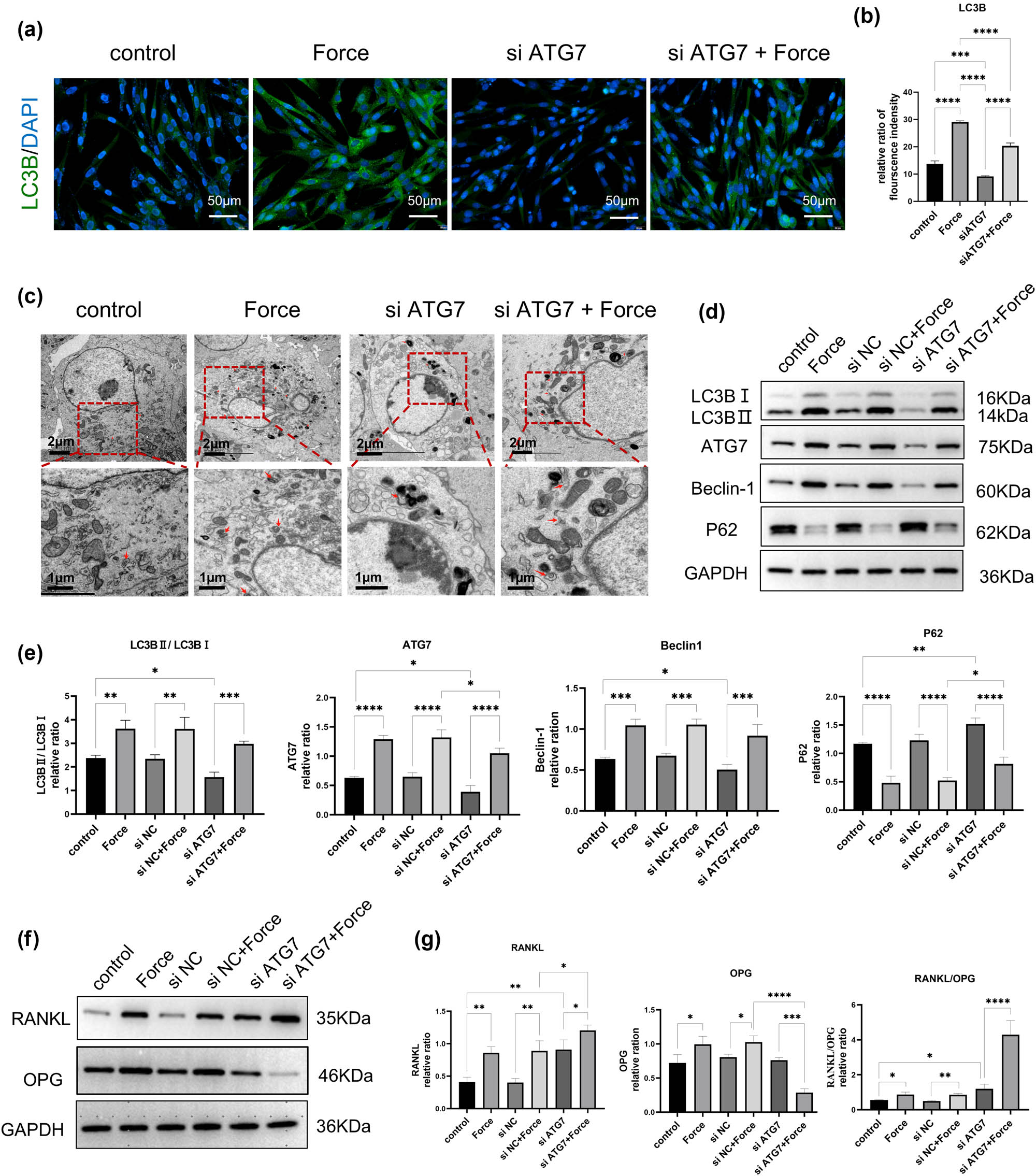Figure 4 
                  Knockdown of the ATG7 gene inhibits compressive stress-induced autophagy and promotes osteoclast differentiation in hPDLSCs. (a) and (b) The protein level of LC3B was detected by immunofluorescent staining. The immunofluorescence intensity of LC3B was enhanced under stress and decreased under siATG7 transfection. In hPDLSCs-siATG7 under the stress group, the immunofluorescence intensity enhanced again. (c) Autophagosomes were observed by TEM. The number of autophagosomes increased under stress, and decreased after ATG7 knockdown in hPDLSCs, which increased again by stress stimuli on hPDLSCs-siATG7. (d) and (e) Western blot results of autophagy-related genes and the quantitative analysis of protein expression levels. (f) and (g) Western blot results of RANKL/OPG expression and the quantitative analysis of protein expression levels. n = 3; *p < 0.05; **p < 0.01; ***p < 0.001; ****p < 0.0001.
               