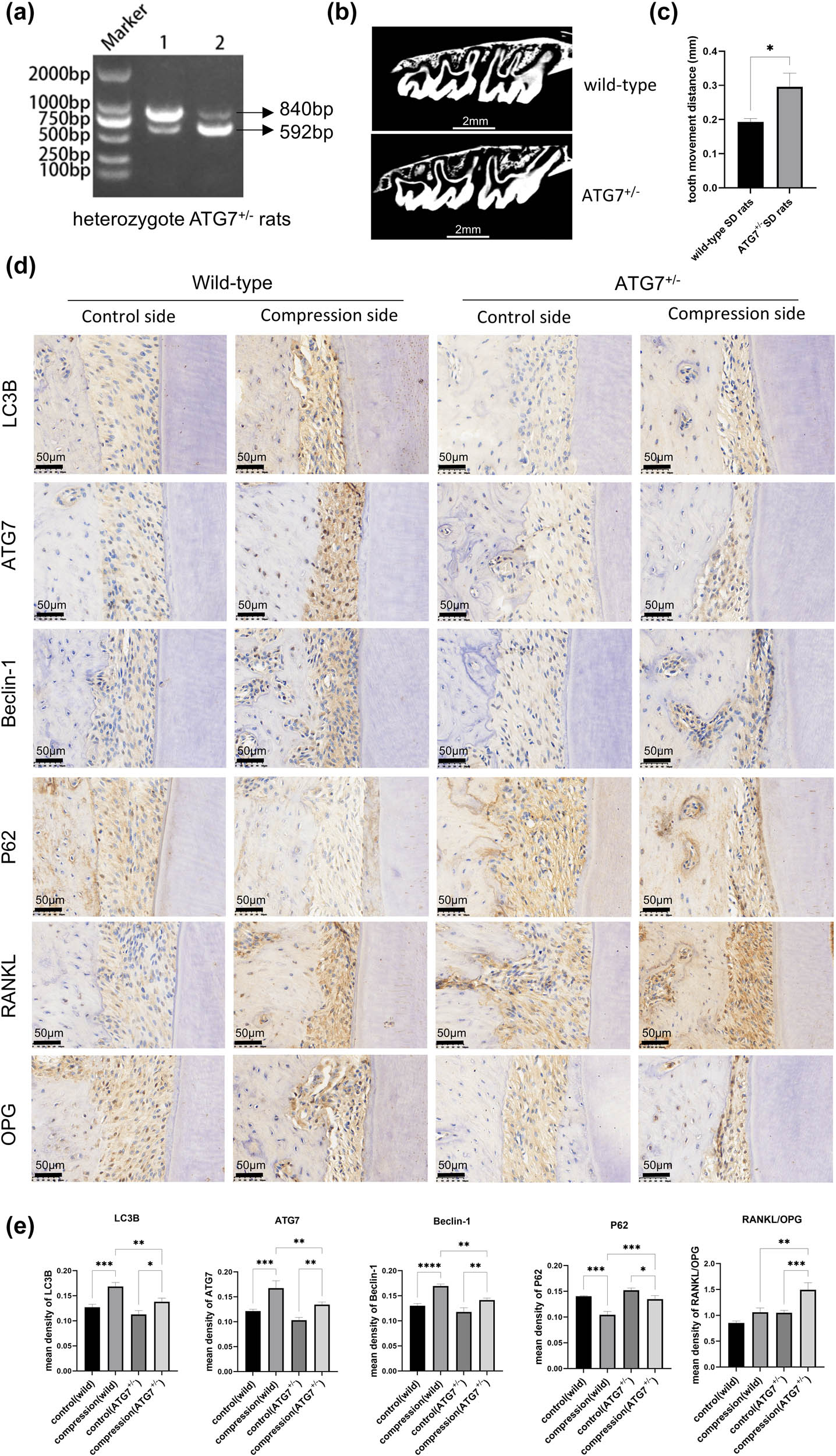 Figure 5 
                  Heterozygous ATG7+/− rats enhanced OTM in the orthodontic model. (a) Rats were identified by performing PCR. (b) and (c) Micro-CT scan and analysis. The results of tooth movement data are expressed as mean ± SD; the wild-type group was 0.193 ± 0.01 mm, and the ATG7+/− group was 0.295 ± 0.04 mm. (d) and (e) Immunohistochemistry staining and its quantitative analysis for autophagy proteins, RANKL, and OPG. The autophagy-related proteins in the ATG7+/− group were lower when compared to the wild-type group on the compression side, but with a significantly increased RANKL/OPG expression. n = 3 per group; samples were selected based on the technical quality for histological analysis. *p < 0.05; **p < 0.01; ***p < 0.001; ****p < 0.0001.
               