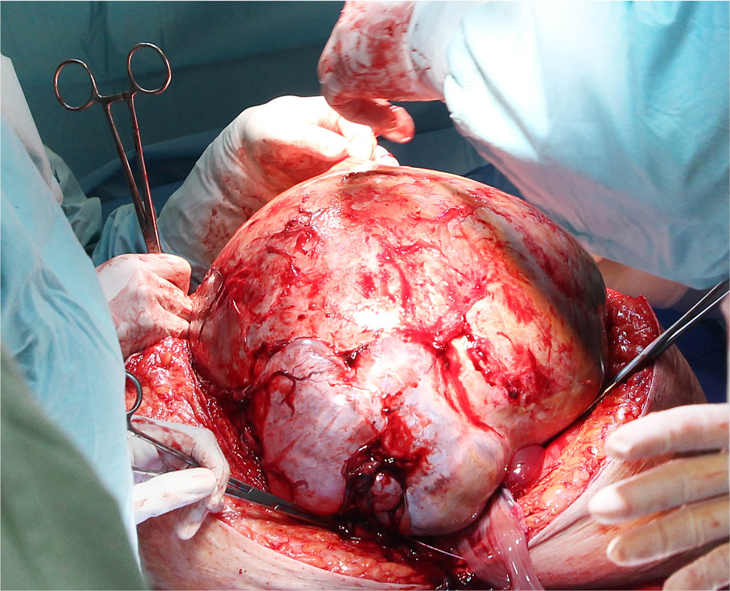 Teaser image from the article