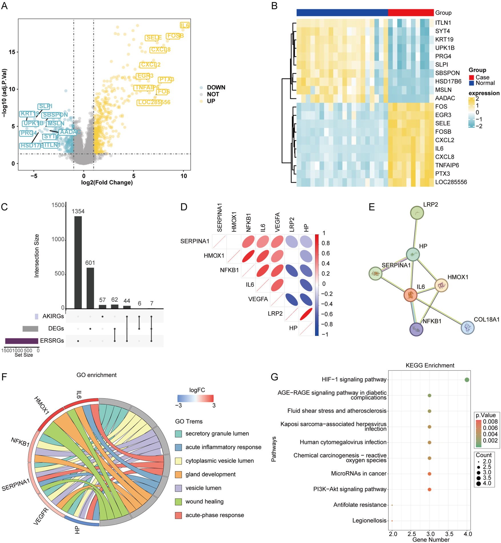 Figure 1:
Identification and enrichment analysis of cross-talk genes. (A) DEGs of GSE4386, bule notes indicate downregulated DEGs, grey nodes indicate no significant, and yellow notes indicate upregulated DEGs. (B) Heat map of top 20 DEGs, the left part represents normal samples, the right part represents case samples, yellow represents upregulation and bule represents downregulation. (C) UpSetR plots depicts the number of unique and shared genes between AKIRGs, DEGs and ERSRGs. (D) Correlation matrix of the 7 cross-talk genes. (E) Interaction map of the 7 cross-talk genes PPI network. (F) GO and (G) KEGG enrichment analysis of the 7 cross-talk genes. AKIRGs, acute kidney injury related genes; DEGs, differentially expressed genes; ERSRGs, endoplasmic reticulum stress-related genes.