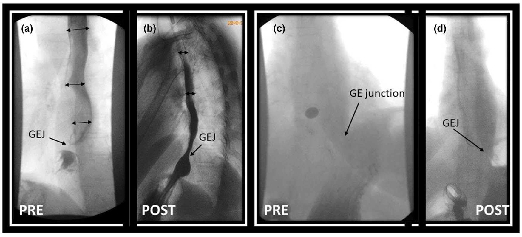 Teaser image from the article