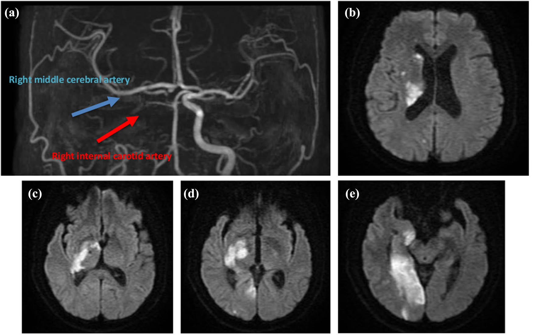 Teaser image from the article