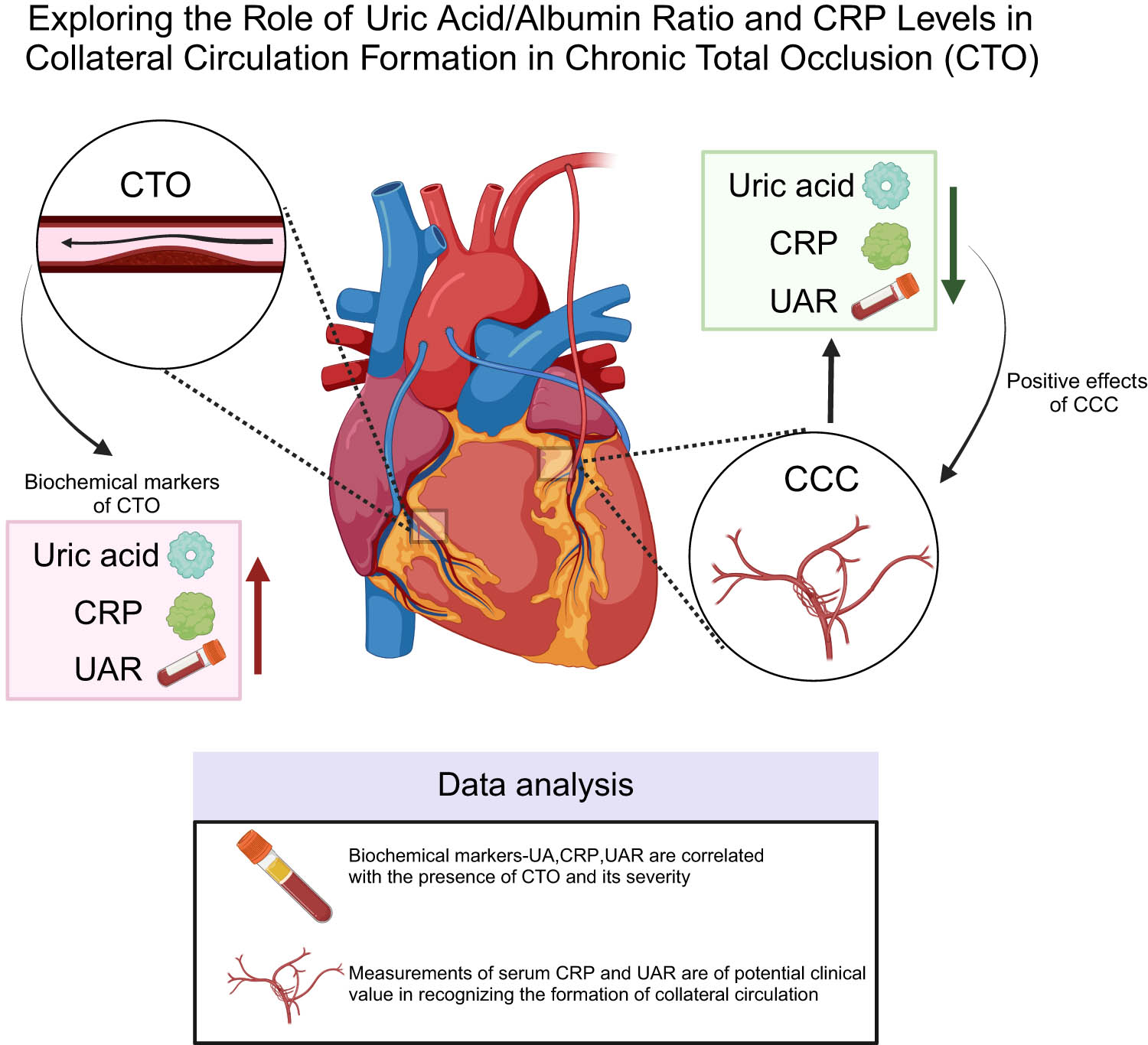 Figure 4 
               Exploring the role of uric acid/albumin ratio and CRP levels in collateral circulation formation in CTO. Note: CRP: C-reactive protein; CTO: chronic total occlusion; UAR: uric acid-to-albumin ratio; and CCC: coronary collateral circulation.
            