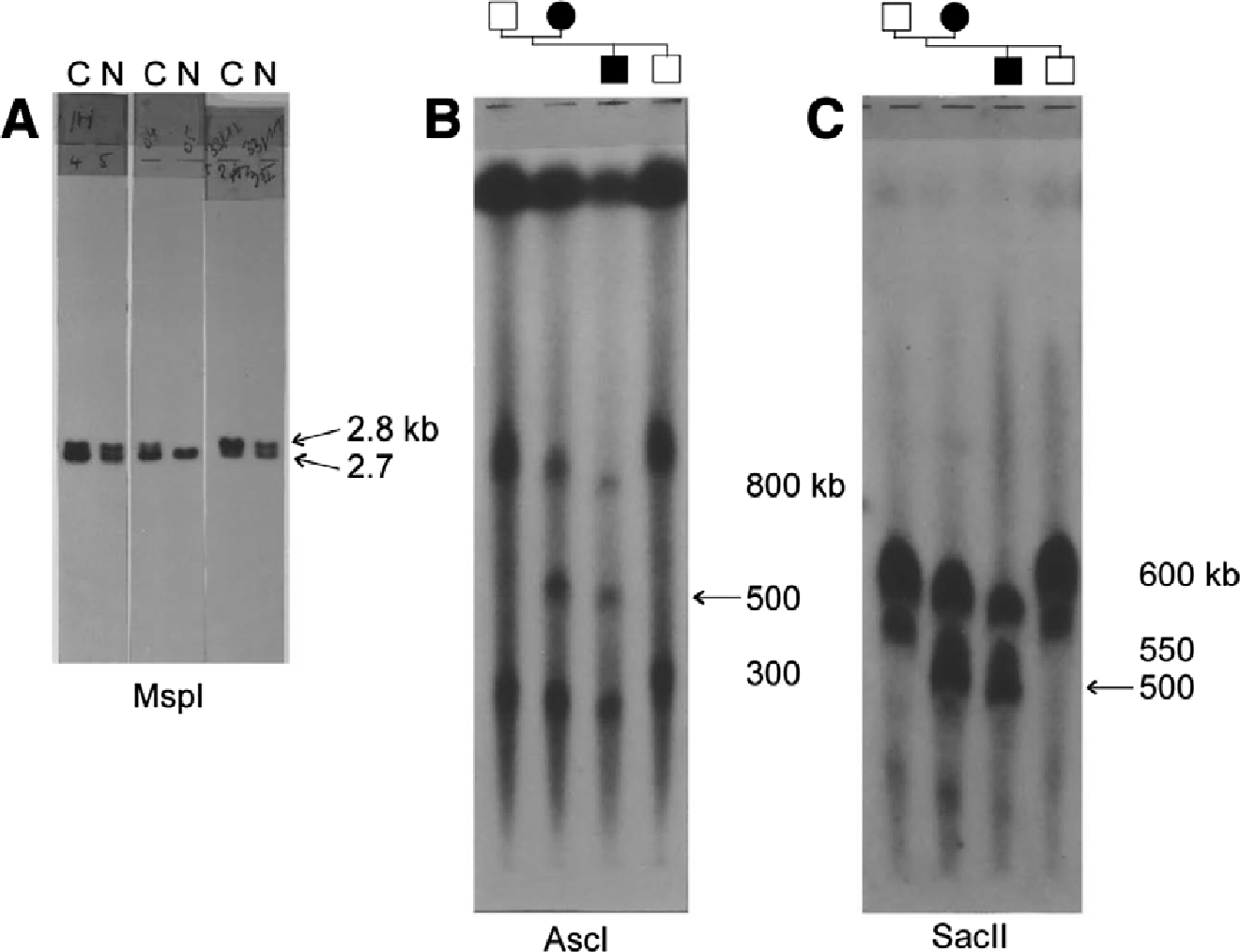 Figure 3 Hybridization signals obtained with probe pVAW409R3a (D17S122). (A) Southern blot of genomic DNA digested with MspI of Charcot-Marie-Tooth neuropathy type 1A (CMT1A) duplication patients (C) and healthy relatives (N) of three different CMT families. Dosage differences between the alleles are seen in each patient, either in the upper allele (2.8 kb) or lower allele (2.7 kb). (B,C) Southern patterns of genomic DNA digested with rare cutter restriction enzymesAscI and SacII. DNA fragments were separated by pulsed-field gel electrophoresis. The 500-kb junction fragment (arrow) is only present in the CMT1A duplication patients belonging to a small branch of the Belgian family CMT-A.