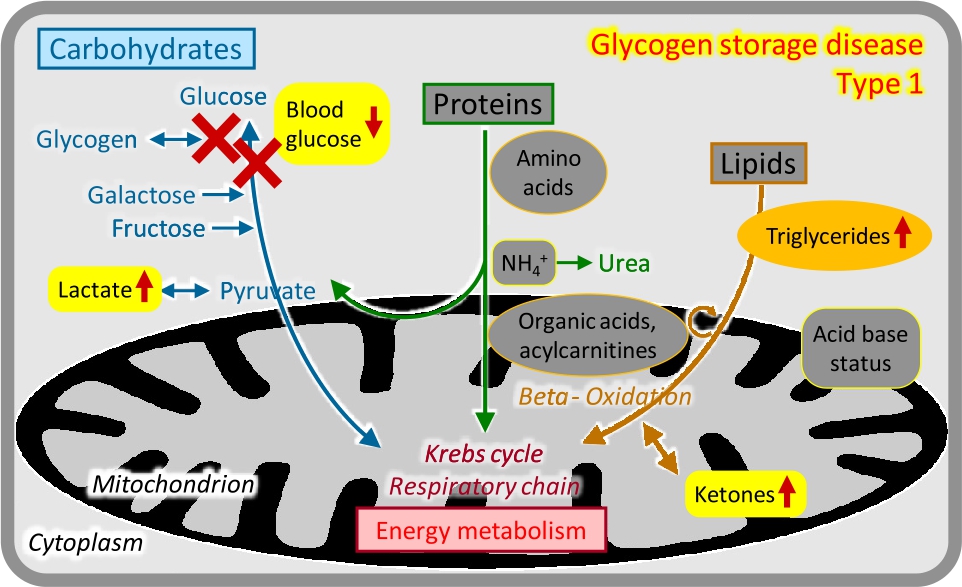 Figure 6 Glycogen storage disease type 1.