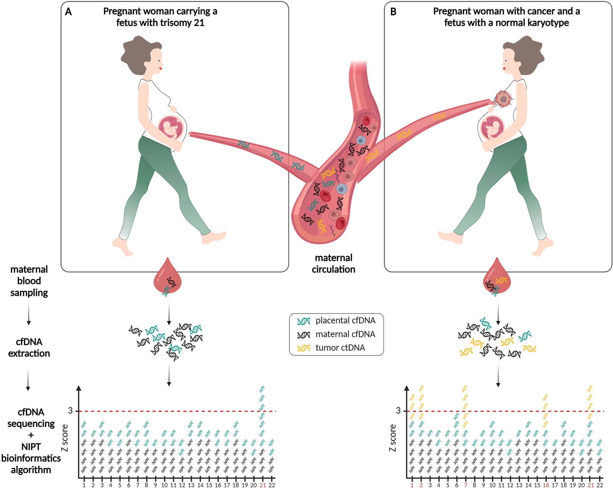 Figure 1: Detection of fetal-derived and tumor-derived copy number alterations via non-invasive prenatal testing (NIPT) during pregnancy. (A) Pregnant woman carrying a fetus with trisomy 21. During pregnancy, cell-free DNA (cfDNA) fragments are released from the placenta (green cfDNA strands) into the maternal circulation and mixed with cfDNA from maternal origin (black cfDNA strands). Upon extraction of cfDNA fragments from maternal plasma, genome-wide sequencing of these fragments and subsequent bioinformatics analysis, the presence of a fetal trisomy 21 is visible as an overrepresentation of cfDNA fragments aligning to chromosome 21 (threshold of standard deviation > 3 (z-score) indicated as dotted red line). (B) Pregnant woman with an (occult) maternal malignancy and carrying a fetus with a normal karyotype. Cell-free tumor DNA (ctDNA) fragments (yellow ctDNA strands), that represent the genetic makeup of the malignancy including chromosomal aberrations, can be shed in the maternal bloodstream. Upon genome-wide NIPT assessment for the presence of chromosomal aneuploidies in the fetus, tumor-derived CNAs will skew the signals, giving rise to an aberrant NIPT result (elevated z-scores for chromosomes 1, 2, 7, 16 and 21 (chromosome numbers indicated in red on the x-axis); vice versa, in case of a (partial) monosomy, the chromosomal z-score would drop below < –3, not depicted here). When the observed aberrations are characteristic for tumor-derived chromosomal imbalances [22] and incompatible with fetal development, a maternal malignancy might be invoked.