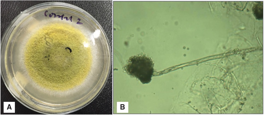 Figure 2 Mycellium and chain of its conidia in B.Colony (A) and cell morphology (B) of selected fungus.