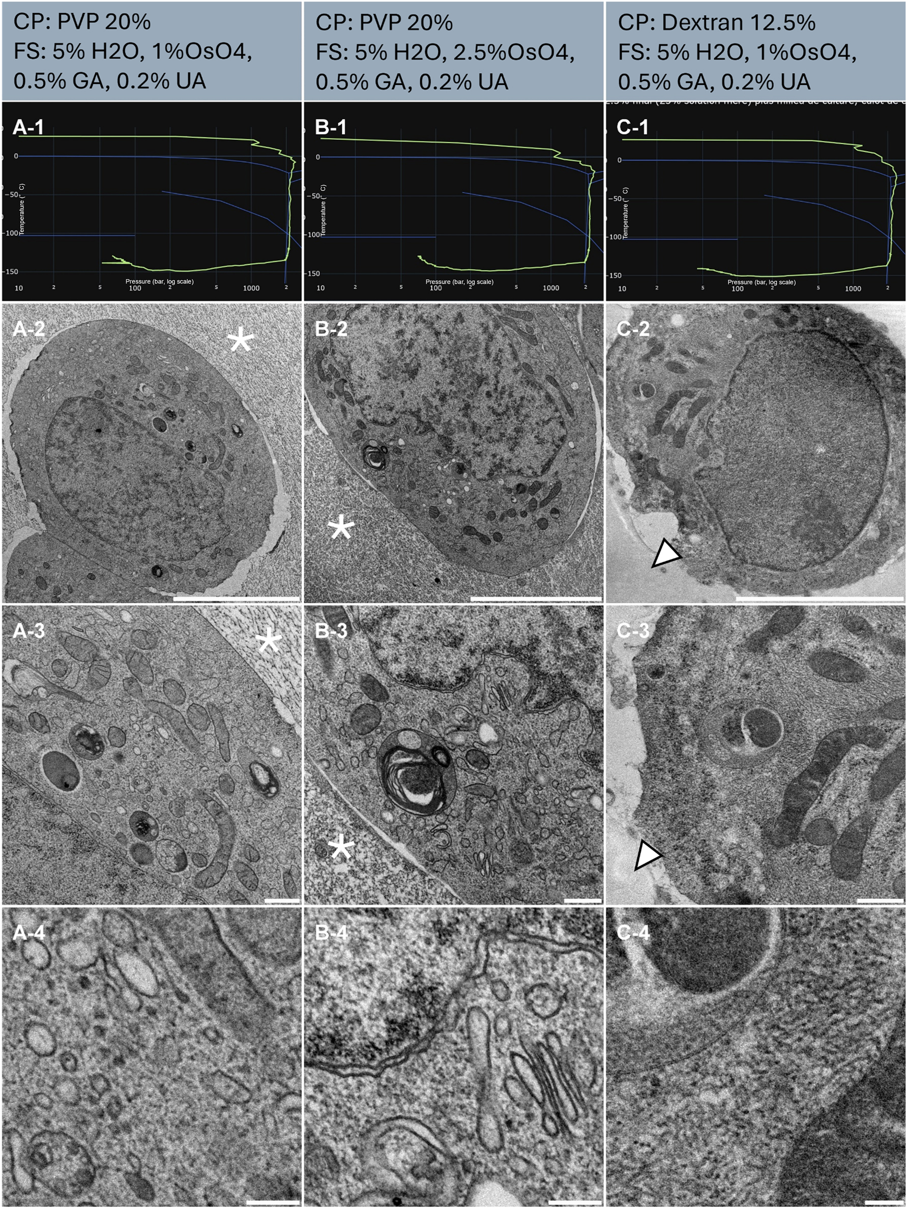 Figure 2:
Morphological observation of 3 samples (column A, B and C) of human cell pellet, concentrated by centrifugation and resuspended in cryo-protectants. The top of the lines presents a cryo-protectant (CP) and a freeze substitution (FS) cocktail for each sample. Line 1 presents each individual HPF curve. X axis: pressure (bar, log scale), Y axis: temperature (°C), green line: experimental curve (pressure/temperature). Blue lines draw a water phase diagram in the region of interest. Line 2 presents an overview of the samples, scale bar 5 µm. Line 3 presents general organelle preservation and distribution, scale bar 1 µm. Line 4 presents a higher magnification of a detailed view, scale bar 0.2 µm. Asterisks represent ice crystals. Arrowheads point to the dextran surrounding the cell without damage.