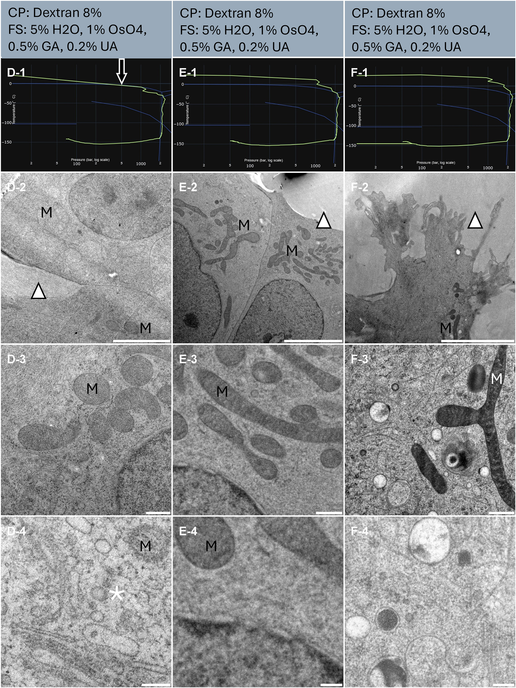 Figure 3:
Morphological observation of 3 samples (column D, E and F) of human cell monolayer cultured onto CryoCapsule. The top of the lines presents a cryo-protectant (CP) and a freeze substitution (FS) cocktail for each sample. Line 1 presents each individual HPF curve. X axis: pressure (bar, log scale), Y axis: temperature (°C), green line: experimental curve (pressure/temperature). Blue lines draw a water phase diagram in the region of interest. Line 2 presents an overview of the samples, scale bar 5 µm. Line 3 presents general organelle preservation and distribution, scale bar 0.5 µm. Line 4 presents a higher magnification of a detailed view, scale bar 0.2 µm. The arrow on the HPF curves points to the early entry into the solidification phase. Asterisks represent ice crystals. Arrowheads point towards the dextran that displays smooth preservation. M localize to the mitochondria.