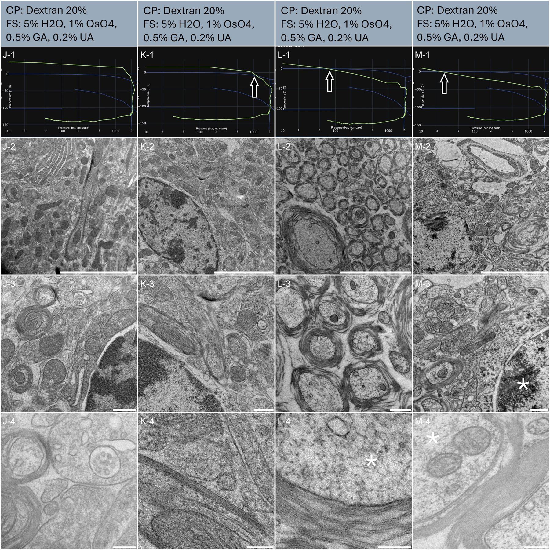 Figure 5:
Morphological observation of 4 samples (column J, K, L and M) of mouse brain biopsies, sliced using vibratome. The top of the lines presents a cryo-protectant (CP) and a freeze substitution (FS) cocktail for each sample. Line 1 presents each individual HPF curve. X axis: pressure (bar, log scale), Y axis: temperature (°C), green line: experimental curve (pressure/temperature). Blue lines draw a water phase diagram in the region of interest. Line 2 presents an overview of the samples, scale bar 5 µm. Line 3 presents general organelle preservation and distribution, scale bar 0.5 µm. Line 4 presents a higher magnification of a detailed view with membranes, myelin sheath, neuronal vesicles and cytoplasm, scale bar 0.2 µm. Arrows on the HPF curves present problematic points of the curves. Asterisks represent ice crystals.
