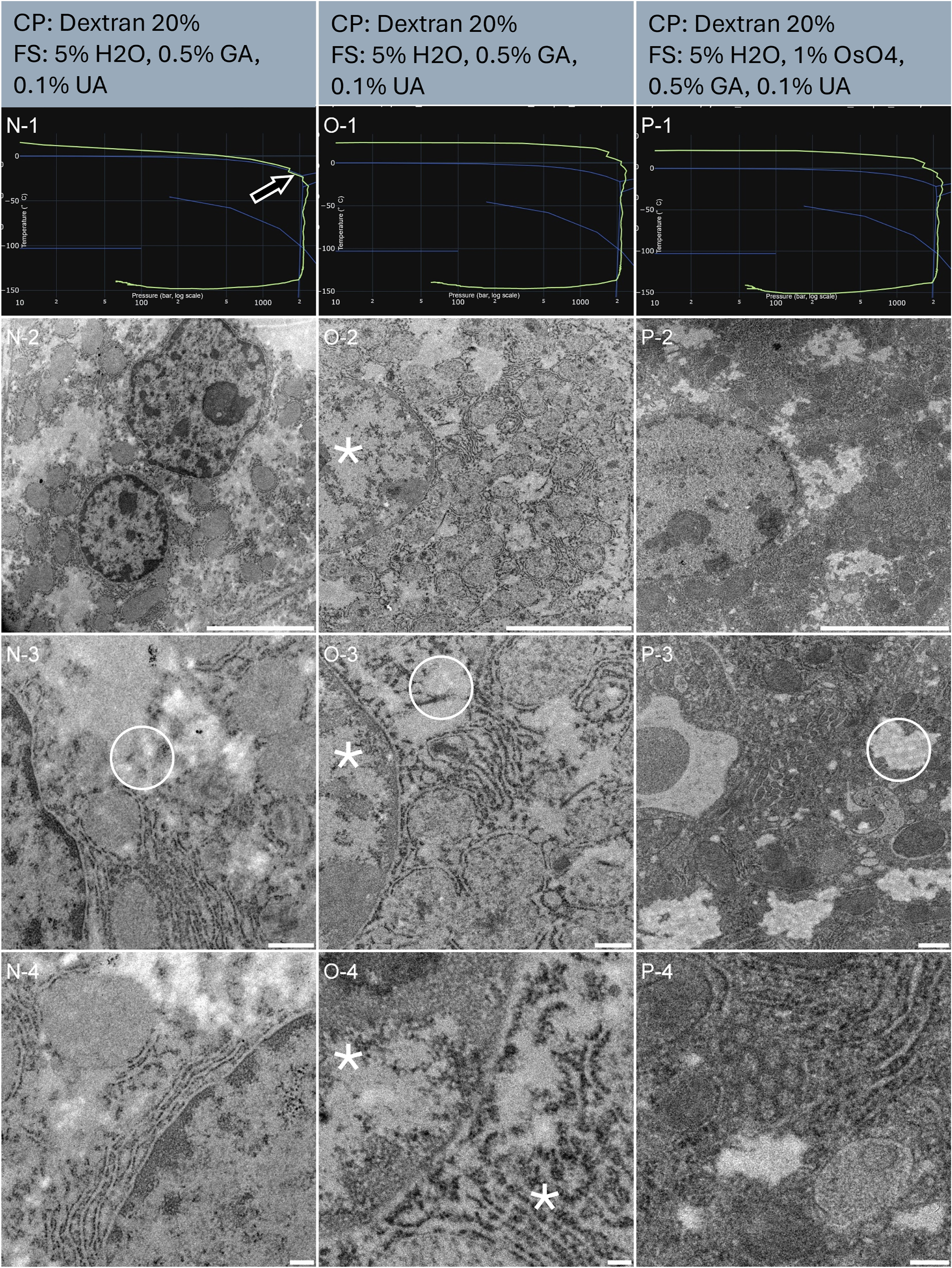 Figure 6:
Morphological observation of 3 samples (column N, O, and P) of mouse liver biopsies, sliced using an oscillating knife ultramicrotome. The top of the lines presents a cryo-protectant (CP) and a freeze substitution (FS) cocktail for each sample. Line 1 presents each individual HPF curve. X axis: pressure (bar, log scale), Y axis: temperature (°C), green line: experimental curve (pressure/temperature). Blue lines draw a water phase diagram in the region of interest. Line 2 presents an overview of the samples, scale bar 5 µm. Line 3 presents general organelle preservation and distribution, scale bar 0.5 µm. Line 4 presents a higher magnification of a detailed view, scale bar 0.2 µm. The arrow on the HPF curve points to the entry into the solidification phase, here at the expected pressure. Asterisks represent ice crystals. Circles are the cytoplasm void areas, containing electron-lucent vesicles, as seen in chemical fixation protocols.