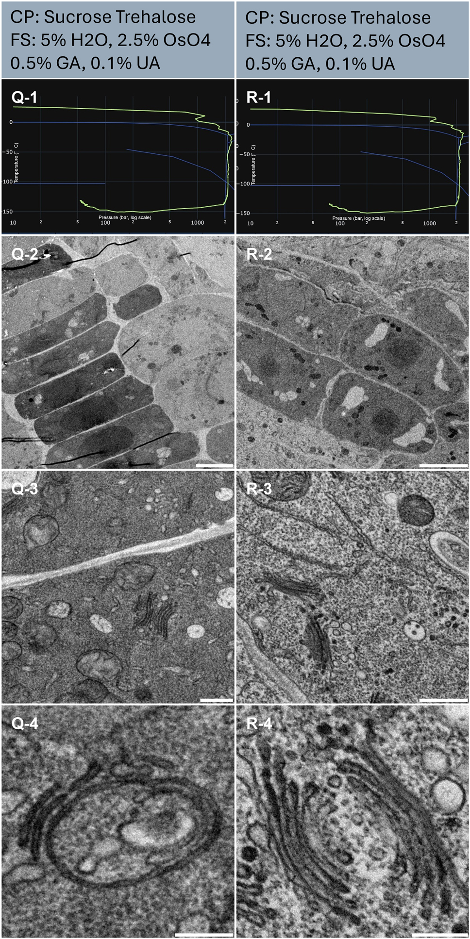 Figure 7:
Morphological observation of 2 samples (column Q and R) of Arabidopsis thaliana root. The top of the lines presents a cryo-protectant (CP) and a freeze substitution (FS) cocktail for each sample. Line 1 presents each individual HPF curve. X axis: pressure (bar, log scale), Y axis: temperature (°C), green line: experimental curve (pressure/temperature). Blue lines draw a water phase diagram in the region of interest. Line 2 presents an overview of the samples, scale bar 10 µm. Line 3 presents general organelle preservation and distribution, scale bar 1 µm. Line 4 presents a higher magnification of a detailed view of membranes from Golgi apparatus and endosomes, scale bar 0.2 µm.