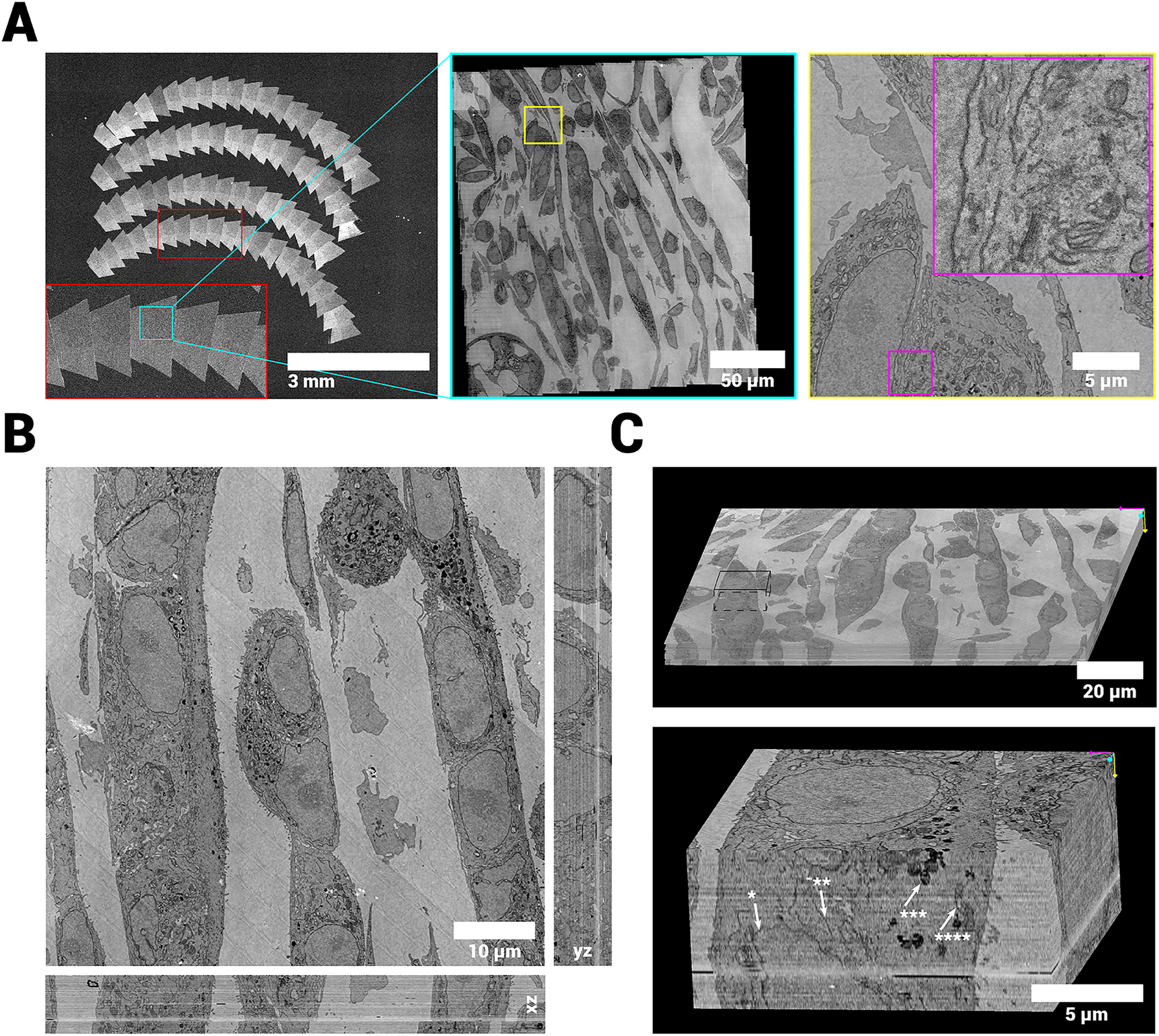 Figure 5:
vEM reconstruction of cultured MCF-7 cells. A Overview images of sections, showing a zoom in on a single ROA, a single field and a single cell respectively. B Aligned volume reconstruction from 72 100 nm serial sections showing the orthogonal reslices through the center of the stack (xz and yz). C Volume rendering of the full (continuous) stack. Inset shows smaller subvolume at 8 nm/pixel resolution with arrows pointing at structures of interest (star indicators: *=nuclear membrane, **=endoplasmatic reticulum, ***=lysosome, ****=Mitochondrium). The data quality and alignment is consistent throughout the stack. The complete 3D dataset at full resolution is available via Nanotomy.
http://www.nanotomy.org/OA/Kievits2024MIM/index.html.