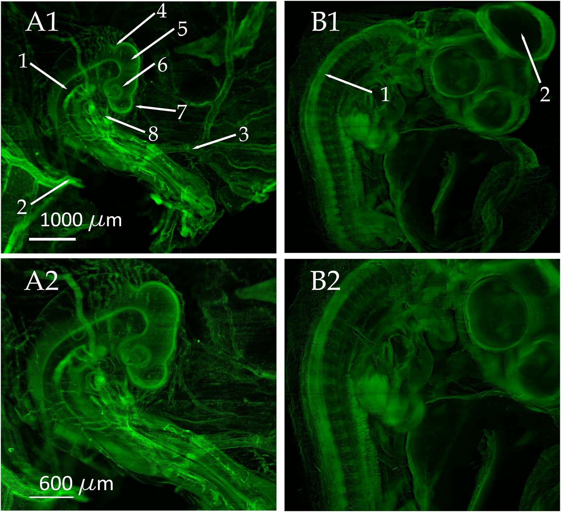Figure 4: 
3D reconstructions of chicken embryos obtained with our optimized light sheet microscopy setup. For image recording a 2X objective (XL-Flour, NA 0.14, Olympus, Japan) and an Andor Neo 5.5 sCMOS camera (Andor, UK) was used. The objective was equipped with a custom-made modulator for compensating the refractive index mismatch. (A1 and A2) 3D reconstruction obtained from a 3-day-old chicken embryo. The MIP projections were computed from 679 single optical slices. Multiple anatomical details as the dorsal aorta (A1-1), the left omphalo-mesenteric artery (A1-2), the right omphalo-mesenteric (vitelline) artery (A1-3), isthmus (A1-4), mesencephalon (A1-5), optic cup (A1-6), diencephalon (A1-7), and heart (A1-8) can be clearly distinguished in the images. To enhance the visibility of fine details, image A2 is magnified by a factor of 1.67. (B1 and B2) MIP projections of a 5-day-old chicken embryo obtained from 607 optical slices. Additionally, to the anatomical structures visible in (A1 and A2), the neural tube (B1-1) and the Mesencephalon (B1-2) can clearly be seen on day 5. To enhance the visibility of fine details, image B2 is magnified by a factor of 1.67.