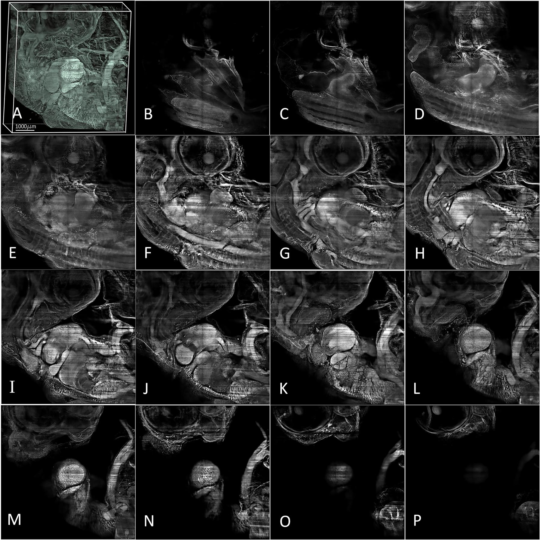 Figure 5: 
A 3D image of a 7-day-old chick embryo was reconstructed using 1,350 images with a 2 µm interval captured by a 2X objective (NA: 0.14, Olympus/Japan) equipped with a modulator to compensate for refractive index mismatch. Imaging was performed with a Neo 5.5 sCMOS camera (Andor, UK) and processed using Amira software. Single images of various planes within the sample were obtained using thin light sheet illumination, with intervals of 100 µm. The images range from B (representing 100 µm from the deepest part) to P (representing the upper part of the image) over a distance of 1,500 µm.