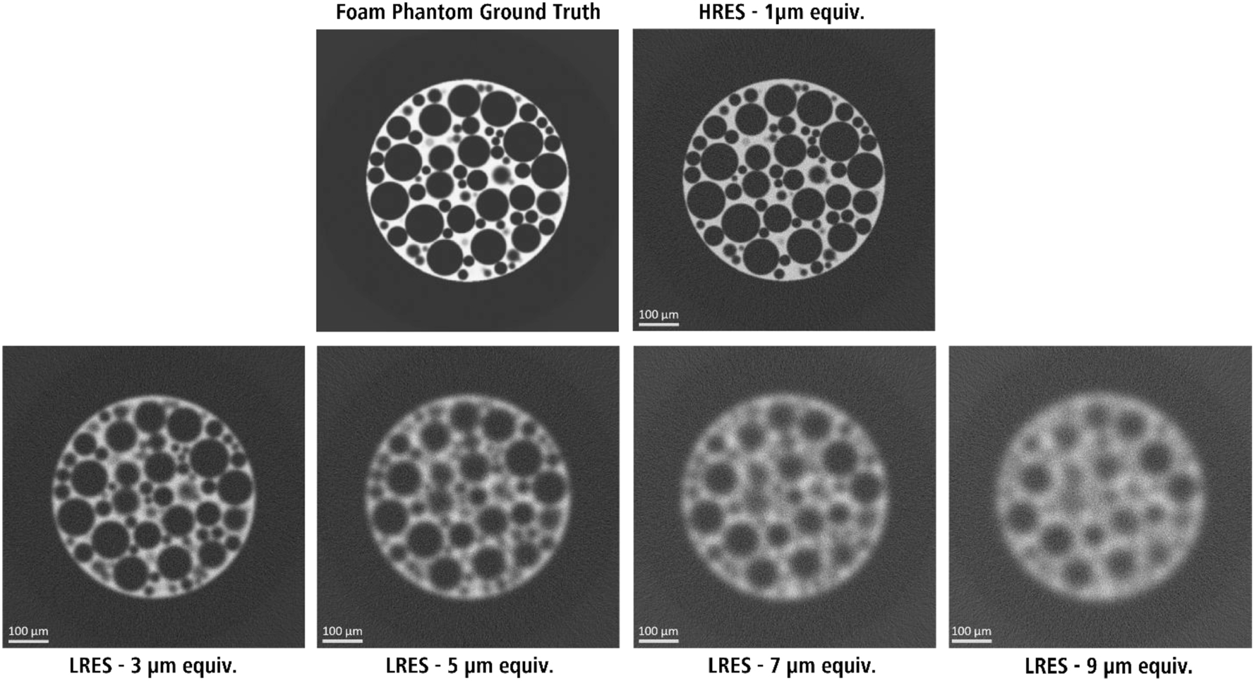 Figure 1:
The foam phantom images used to train the DeepNet models in this study. The low-resolution images (LRES – 3, 5, 7, and 9 µm) were paired with the high-resolution (HRES – 1 µm) image for training.