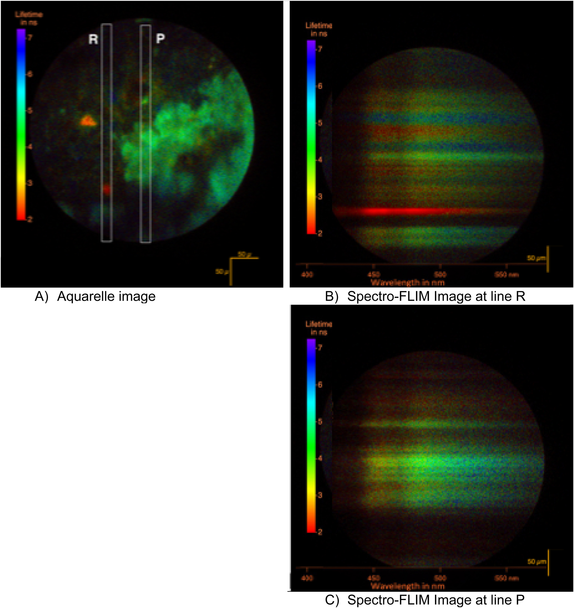 Figure 11: 
FLIM collection of the fossil LAKB2B8 at position X: 6,597 µm; Y: −2,600 µm; collimated shining of 0.07 mW at 343 nm through a 10× objective for 6 min. In (A) the aquarelle image where the brightness codes for the intensity and the color codes for the lifetime. The two short-lived crystals are more clearly seen. In (B) and (C) the slit of 10 nm in spectral width is inserted to select two positions in the previous image. The grating is put into action. Time resolved spectra are recorded. The spectral images are rotated clockwise for a better reading.
