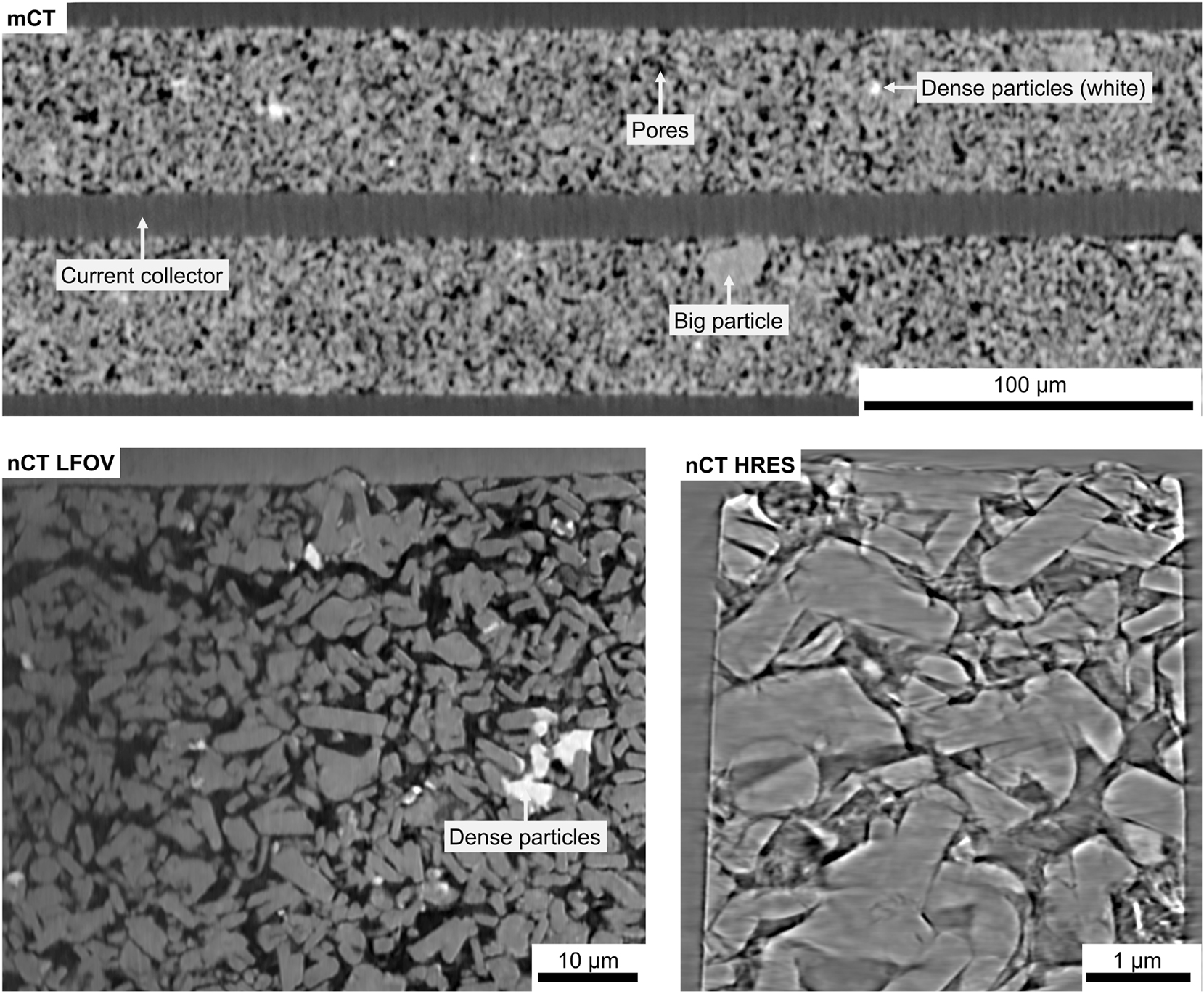 Figure 9:
X-ray microscopy results from the cathode sample, including Micro-CT, Nano-CT LFOV, and Nano-CT HRes scans. Micro-CT provides a large-scale overview, enabling the analysis of particle size distribution and identification of electrode defects. Nano-CT, with its higher resolution, reveals internal defects within particles and, due to phase contrast imaging, allows visualization of binder distribution between particles.