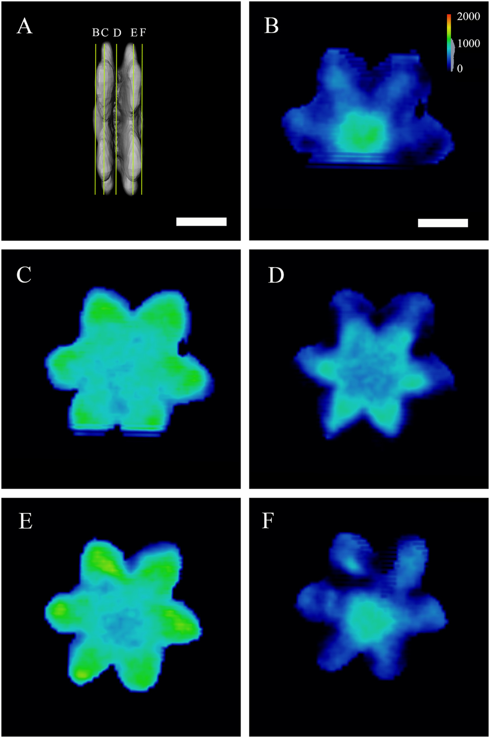 Figure 4:
Slicing through the crystal. (A) Positions of the virtual slices are shown in (B) to (F). Color legend in (B) shows the density of the crystal (in mg/cm3) and is valid for all images. The density of the crystal is in the range from the lowest (430 mg/cm3) to the highest (1,538 mg/cm3). Scale bars are 10 μm.