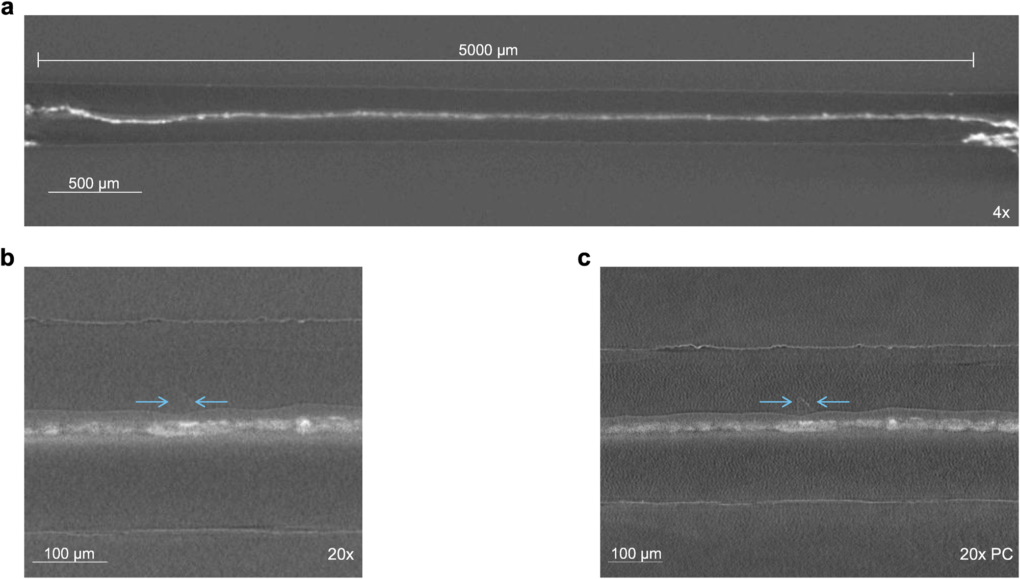 Figure 8:
Post-mortem scans with different settings. a: Overview scans with a high FOV and low resolution with an 4× objective. b: High resolution absorption scan with 20× objectives. c: High resolution scan with 20× objective using propagation-based phase contrast geometry. The arrows highlight a structure which is not visible in absorption focused scans. Note that the magnifications in b and c are different.