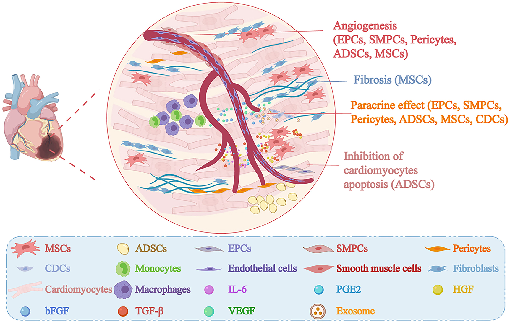Figure 2: 
The roles of resident stem cells in cardiac diseases. After injury, these resident stem/progenitor cells not only differentiate into various types of cells to participate in inflammatory response, angiogenesis, and cardiac fibrosis, but also secrete many factors and exosomes to help maintain vascular homeostasis and inhibit cardiomyocyte apoptosis in the process of myocardial repair. ADSCs: adipose-derived stem cells; bFGF: basic fibroblast growth factor; CDCs: cardiosphere-derived cells; EPCs: endothelial progenitor cells; HGF: hepatocyte growth factor; IL-6: interleukin 6; MSCs: mesenchymal stem cells; PGE2: Prostaglandin E2; SMPCs: smooth muscle progenitor cells. TGF-β: transforming growth factor-β; VEGF: vascular endothelial growth factor. (Adapted from “Histological Evolution of Acute Myocardial Infarction”, by BioRender.com [2020]. Retrieved from https://app.biorender.com/biorender-templates).

