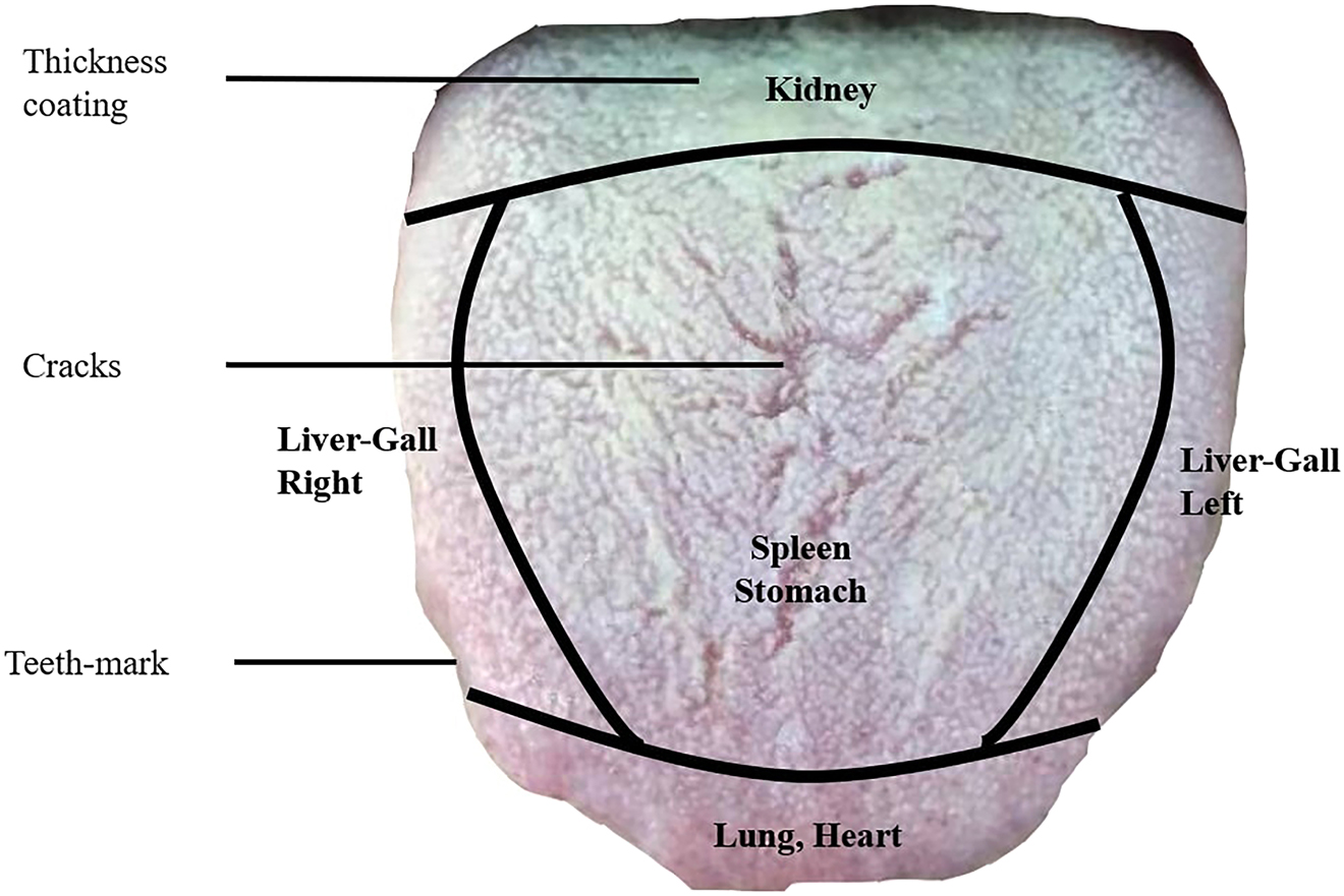 Figure 1: 
Organ correspondence of tongue regions.
