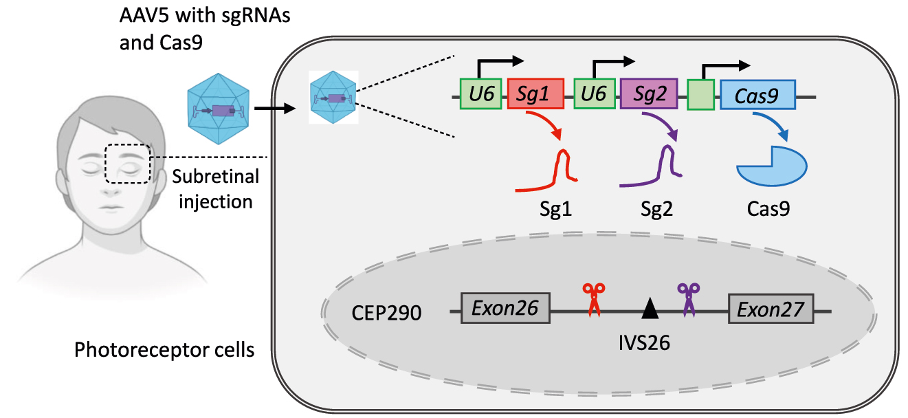 Figure 9: 
Strategy of therapeutic genome editing in vivo for LCA. A pair of sgRNAs and Cas9 are delivered directly to the photoreceptor cells via AAV5 vector after subretinal injection. Cas9 induces deletion of IVS26 mutation which is LCA-associated mutation in the CEP290. LCA, Leber congenital amaurosis.
