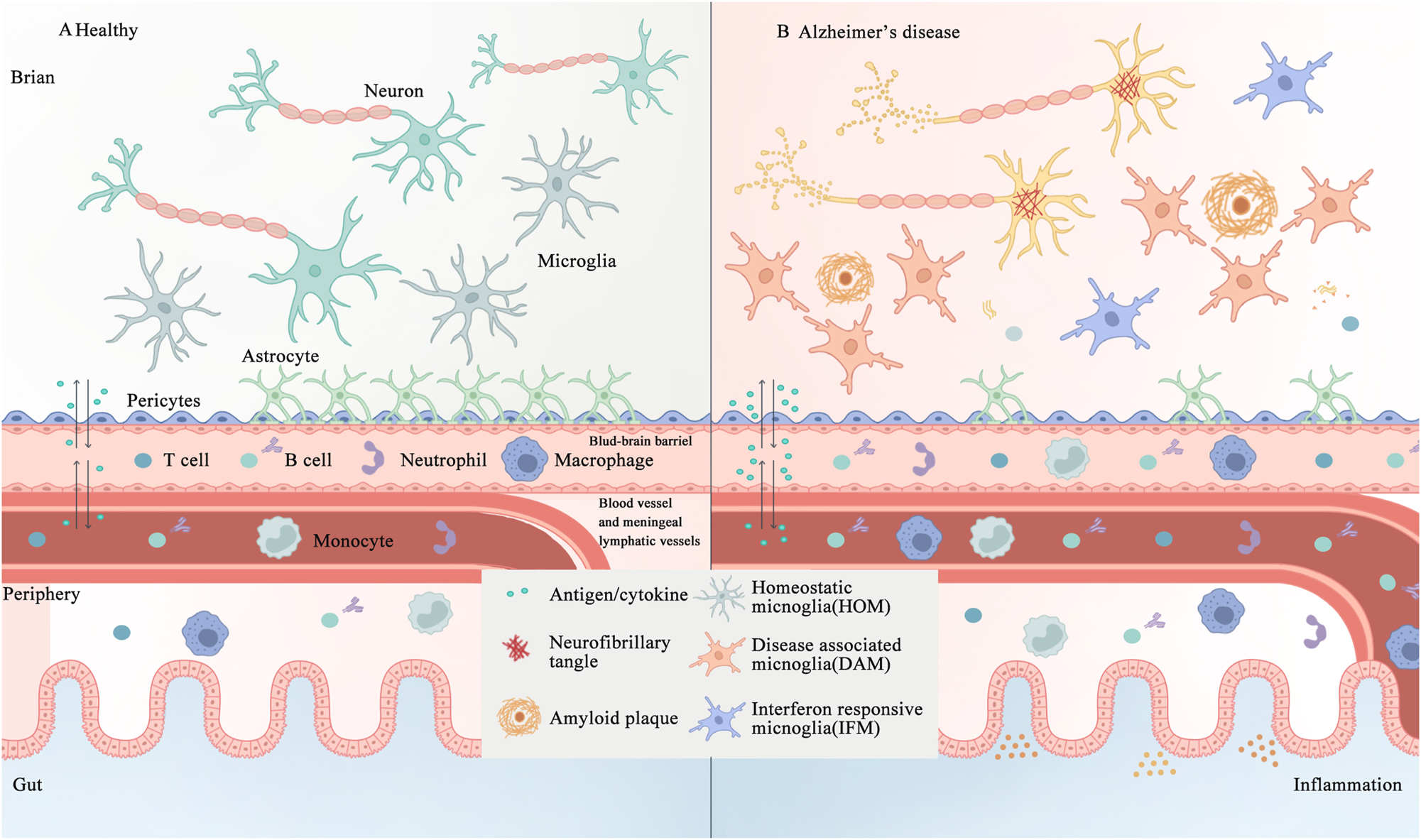 Figure 1: 
The interplay between central and peripheral immune cells in the healthy and AD brain. A. In healthy individuals, microglial cells, astrocytes, and an intact BBB and meningeal lymphatic system collectively maintain the functionality of the brain. B. In AD, the aggregation of Aβ and formation of neurofibrillary tangles composed of hyperphosphorylated tau activate immune cells, thus disrupting the integrity of the BBB, and trigger inflammation both within and outside the brain, including in the gut. AD, Alzheimer’s disease; Aβ, amyloid β-protein; BBB, blood-brain barrier.
