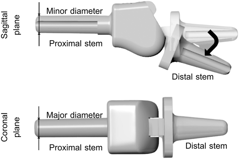 Figure 1: 
Schematic of the investigated prosthesis that was designed to mimic the range of motion with one degree of freedom movement.
