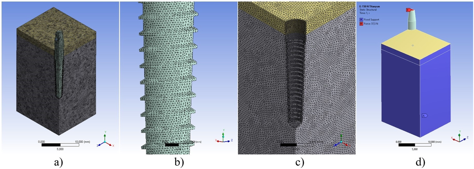 Figure 3: 
Pre-processing steps in FEA of a bone-implant system, a) mesh structure of quarter FEA model, b) mesh detail of implant, c) mesh detail of bone, d) boundary conditions of FEA model.
