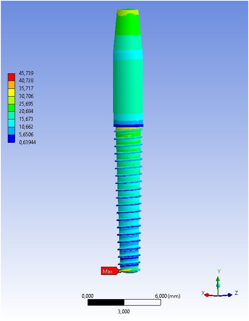 Figure 5: 
von mises stress (MPa) distribution of the implant under 150 N axial load.
