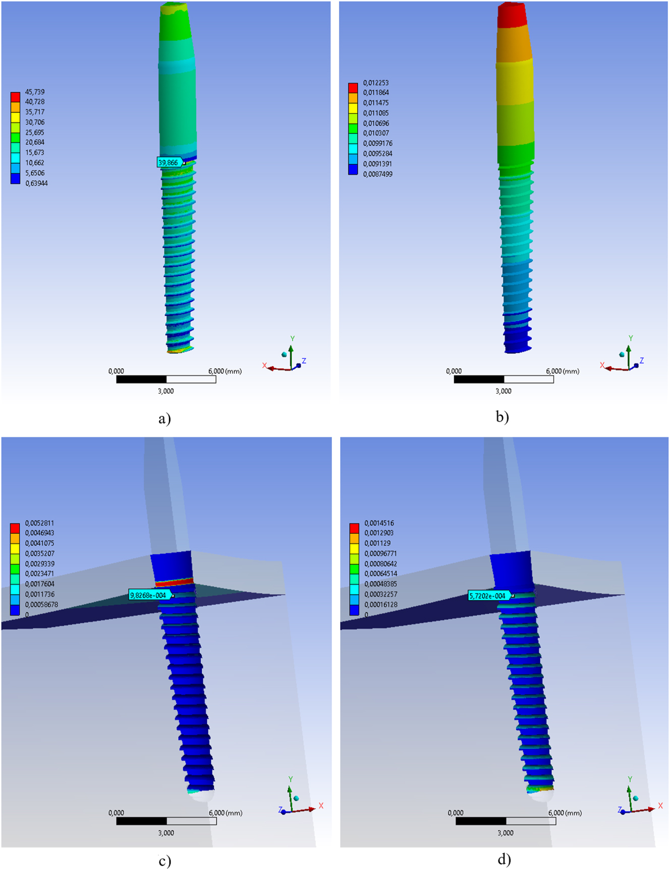 Figure 14: 
Biomechanical analysis results of Ti6Al4V implant, a) equivalent stress (MPa), b) total deformation (mm), c) sliding distance (mm), d) penetration depth (mm).
