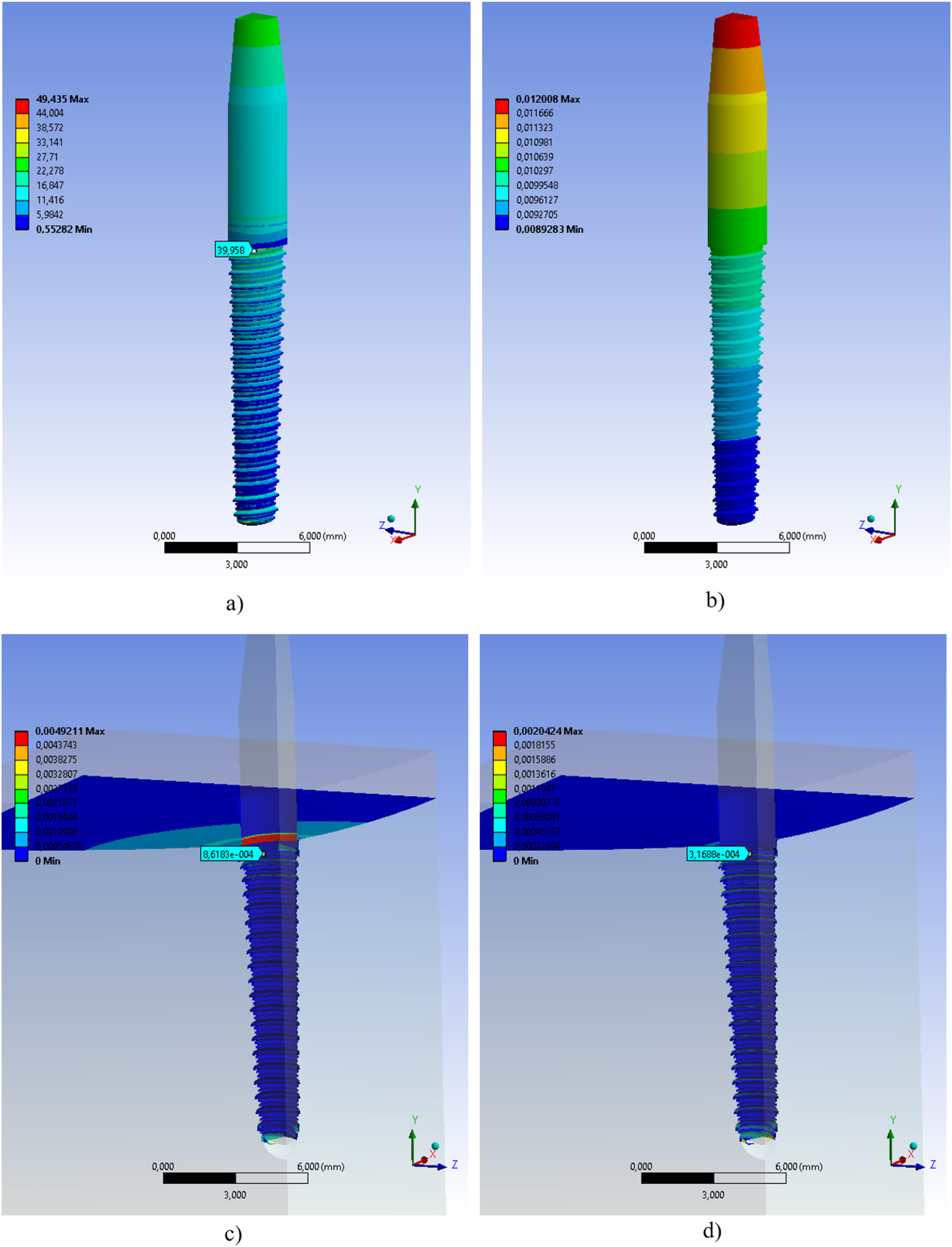Figure 16: 
Biomechanical assessment results of the micro-grooved dental implant with Ti6Al4V, a) equivalent stress (MPa) distribution, b) deformation (mm) distribution, c) sliding (mm) distribution, d) penetration (mm) distribution.
