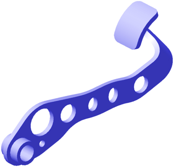 Figure 8: 
Optimized design of vehicle brake pedal using MHOA.

