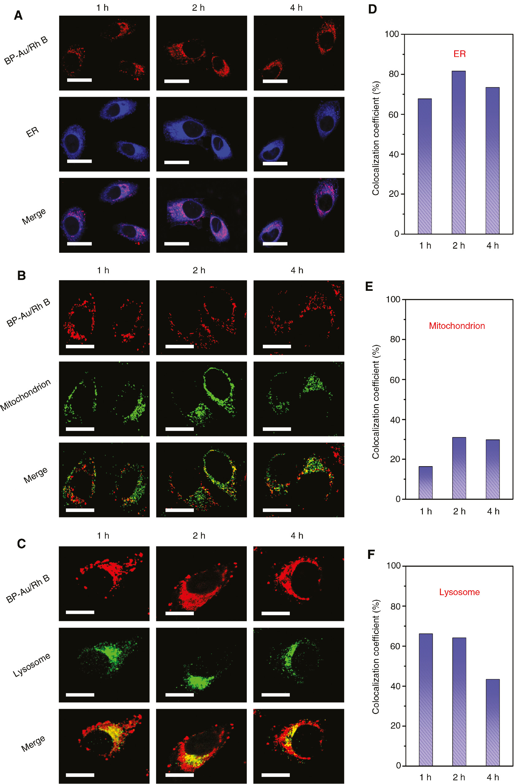 Figure 5: Fluorescence co-localization analysis of BP-Au NSs with the (A) ER, (B) mitochondria and (C) lysosome at different time points. Scale bar: 20 μm. (D–F) Colocalization coefficients between nanohybrids and different organelles.