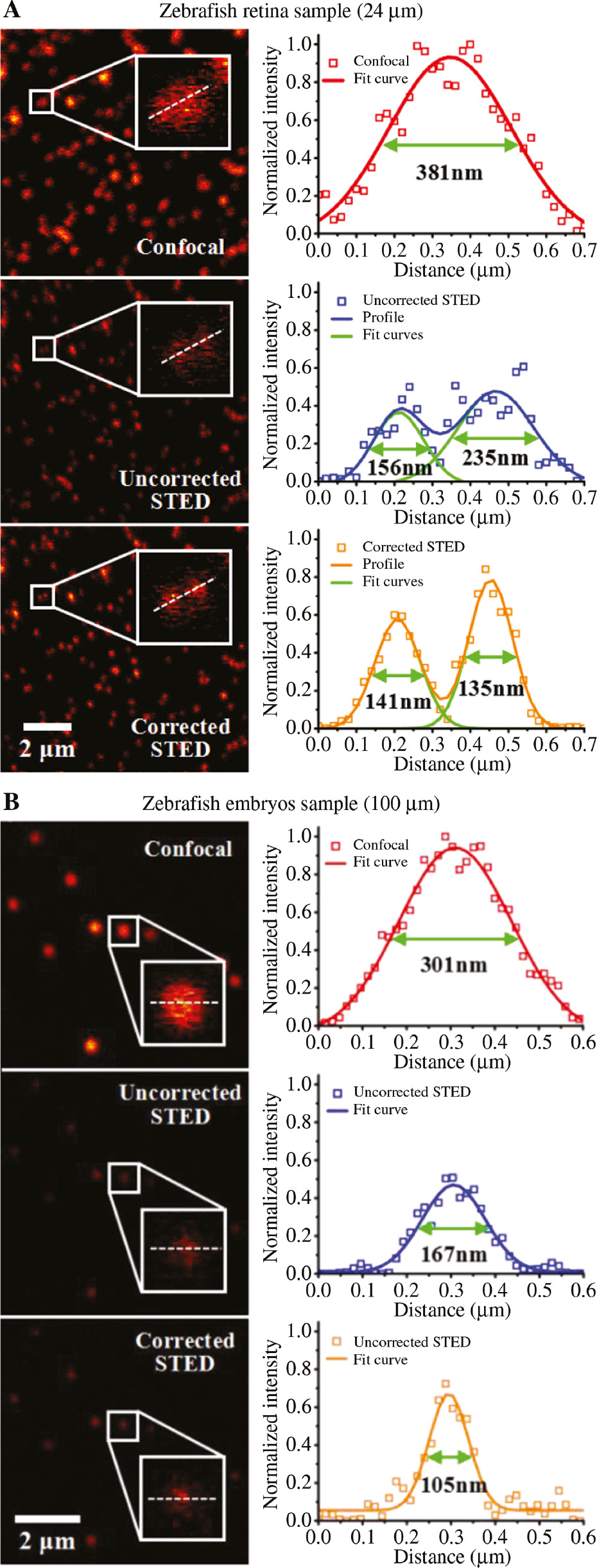 Figure 7: Full aberration correction in zebrafish samples.(A) Images of 100 nm fluorescent microspheres through zebrafish retina with the thickness of 24 μm, and the normalized intensity profiles along white dotted lines. (B) Images of 100 nm fluorescent microspheres though zebrafish embryos section with the thickness of 100 μm, and the normalized intensity profiles along white dotted lines.