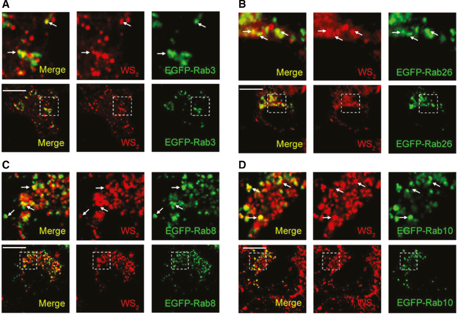 Figure 6: Exocytosis-mediated secretion of WS2 NSs.(A) HeLa cells were transfected with EGFP-Rab3 plasmid, and then the cells were incubated with WS2-PEG/RB NSs for 2 h. The co-localization was determined by CLSM. (B) HeLa cells were transfected with EGFP-Rab26 plasmid, and then the cells were incubated with WS2-PEG/RB NSs for 2 h. The co-localization was determined by CLSM. (C) HeLa cells were transfected with EGFP-Rab8 plasmid, and then the cells were incubated with WS2-PEG/RB NSs for 2 h. The co-localization was determined by CLSM. (D) HeLa cells were transfected with EGFP-Rab10 plasmid, and then the cells were incubated with WS2-PEG/RB NSs for 2 h. The co-localization was determined by CLSM. Scale bars: 10 μm