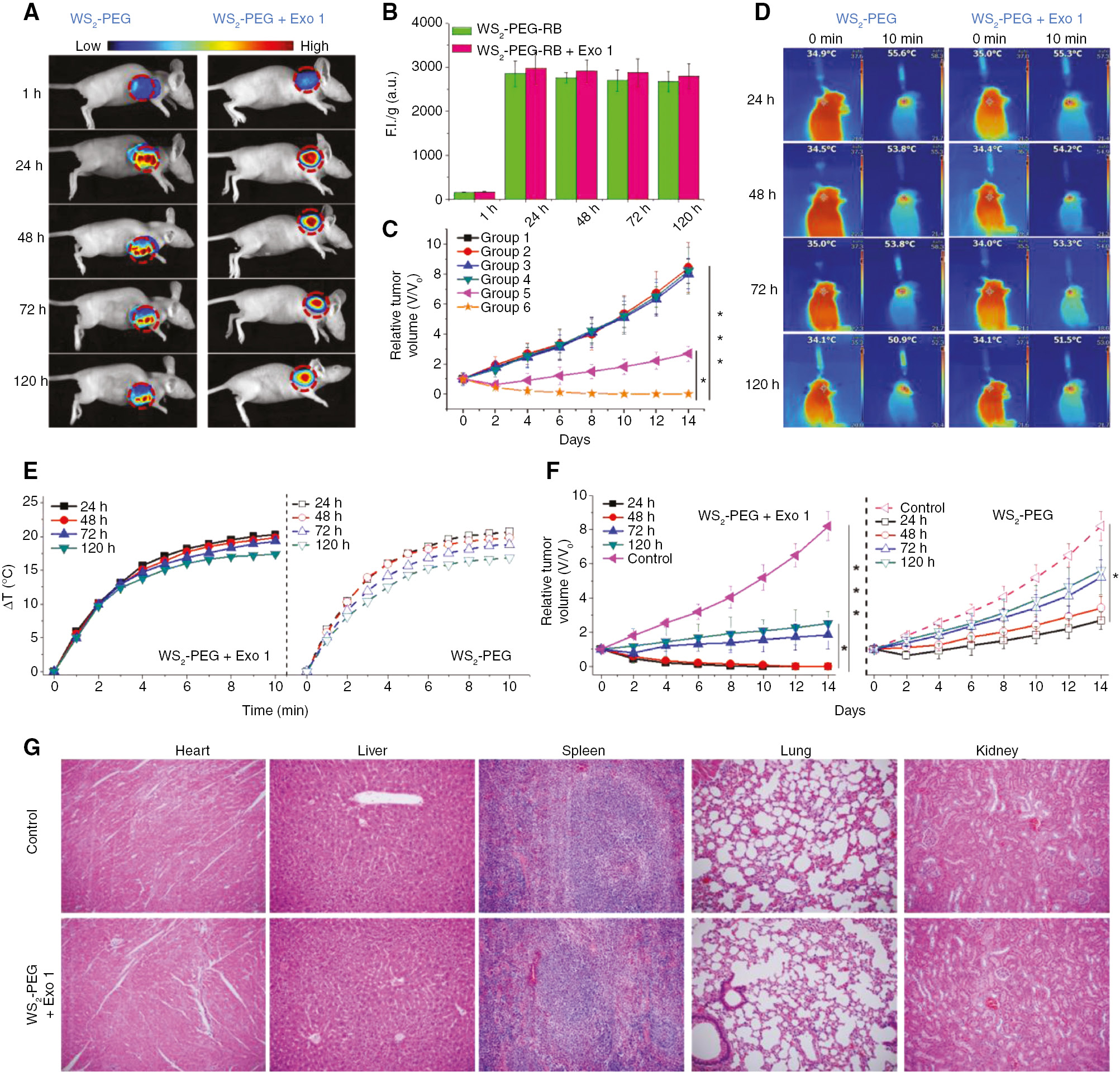 Figure 9: Enhanced photothermal therapeutic outcomes via blocking exocytosis in vivo.(A) Ex vivo fluorescence images of the tumor sites were taken from mice treated with NSs at different time points. (B) Quantitative analysis of the NSs in the tumors. (C) Tumor growth curves of mice with different kinds of treatments. Group 1: saline; Group 2: WS2-PEG NSs; Group 3: WS2-PEG NSs+Exo1; Group 4: Exo1+NIR; Group 5: WS2-PEG NSs+NIR; Group 6: WS2-PEG NSs+Exo1+NIR (WS2-PEG NSs: 6 mg kg−1, intravenous injection; Exo1: 4 mg kg−1, intratumoral injection). Twenty-four hours post injection, Groups 4, 5, and 6 were exposed to NIR radiation at tumor sites (808 nm, 0.5 W cm−2, 10 min). (D) Photothermal images recorded by an IR thermal camera at a different time points. (E) Temperature changes at the tumor sites during the period of NIR irradiation. (F) Relative tumor volumes plotted between different groups. (G) H&E staining images of the major organs. Saline was used in the control group.